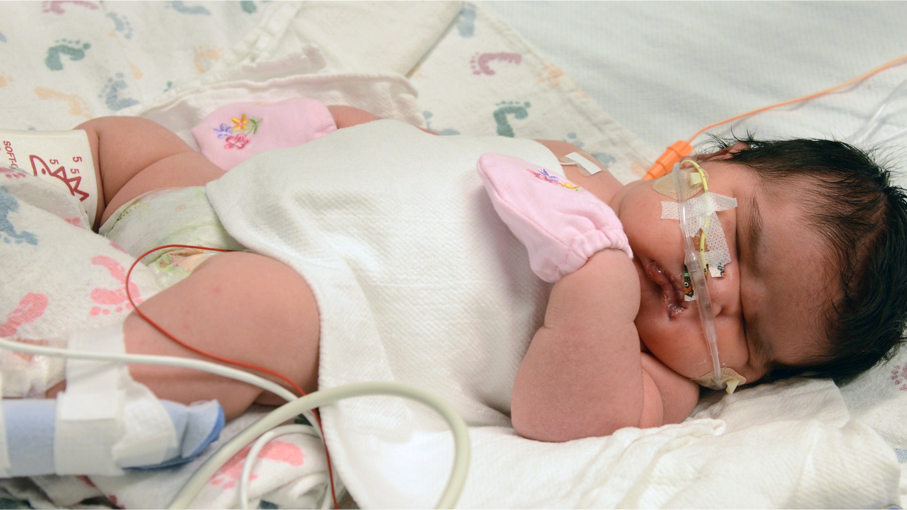 Dec. 2, 2014: This image provided by Children’s Hospital Colorado shows Mia Yasmin Garcia shortly after birth.