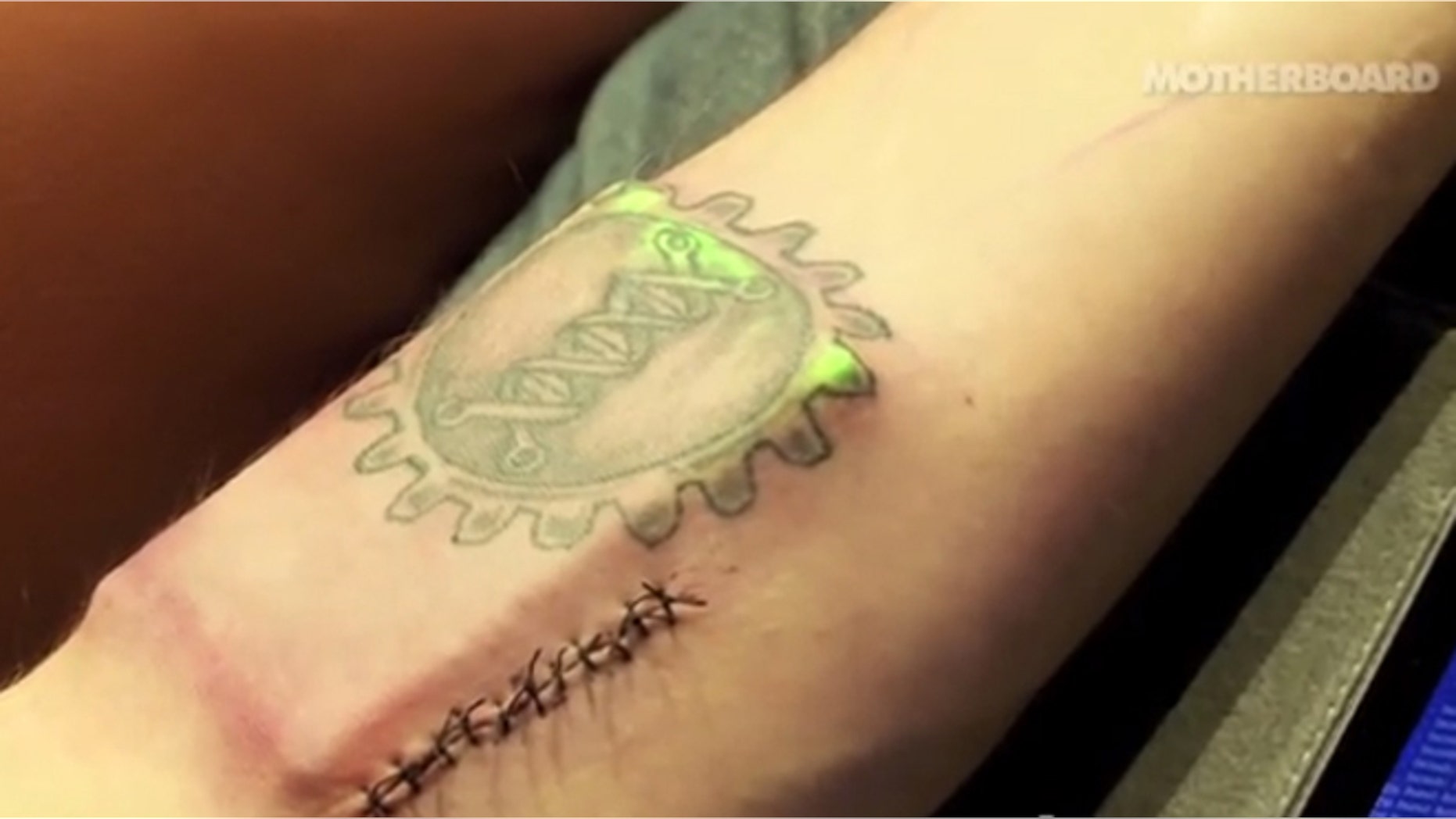 Biohacker Tim Cannon had a battery-powered electronic device installed in his arm.