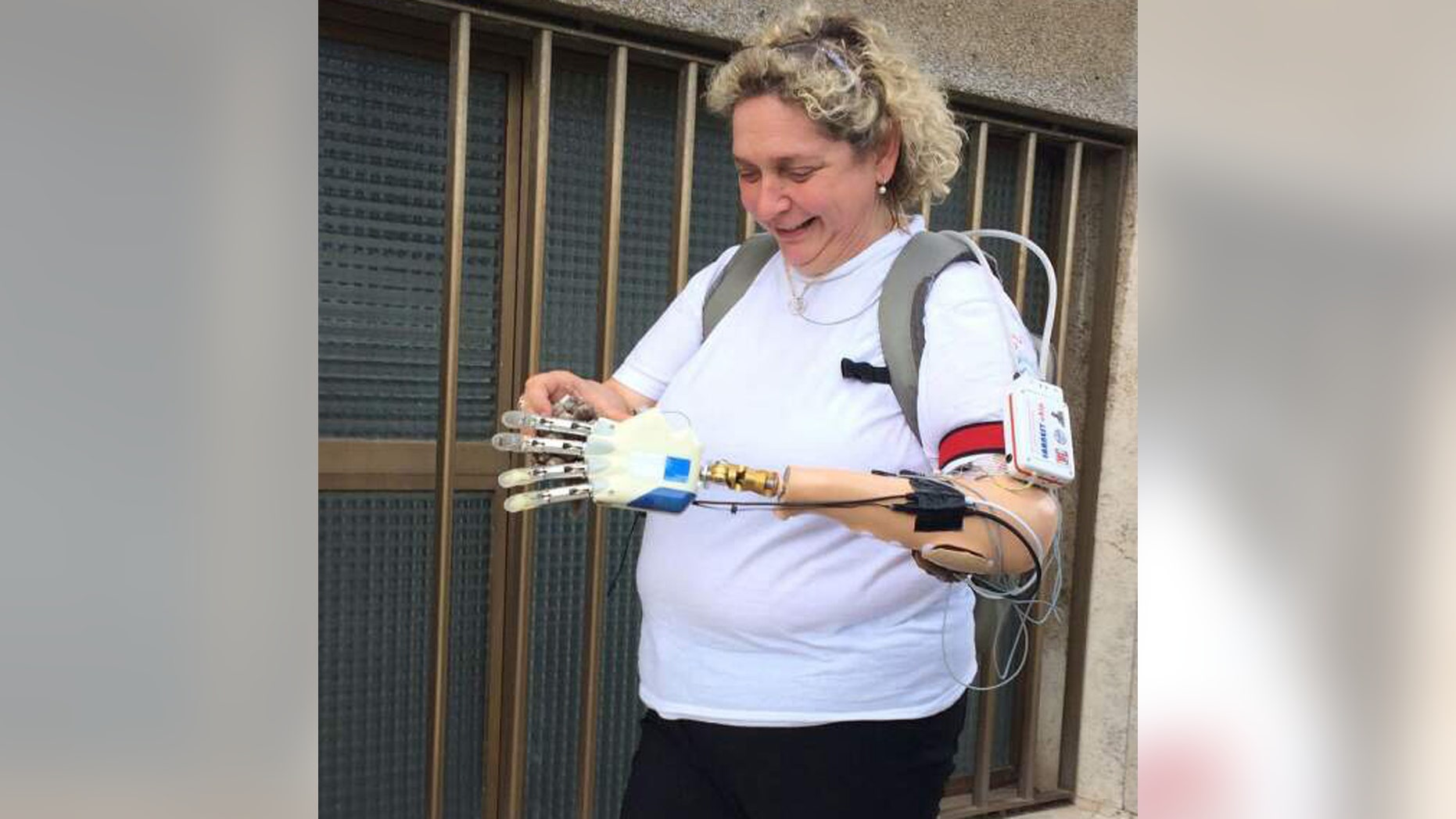 Almerina Mascarello, seen above, was able to use a bionic hand being developed by researchers in Italy.