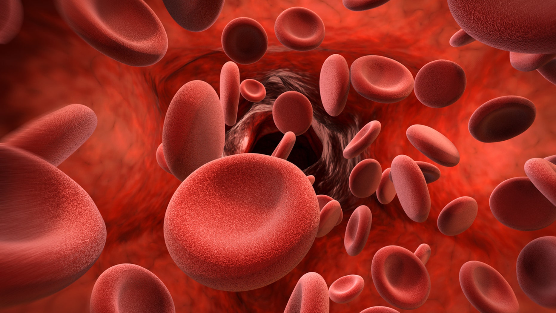 Tracy Antonelli and her daughters have a blood disorder called thalassemia