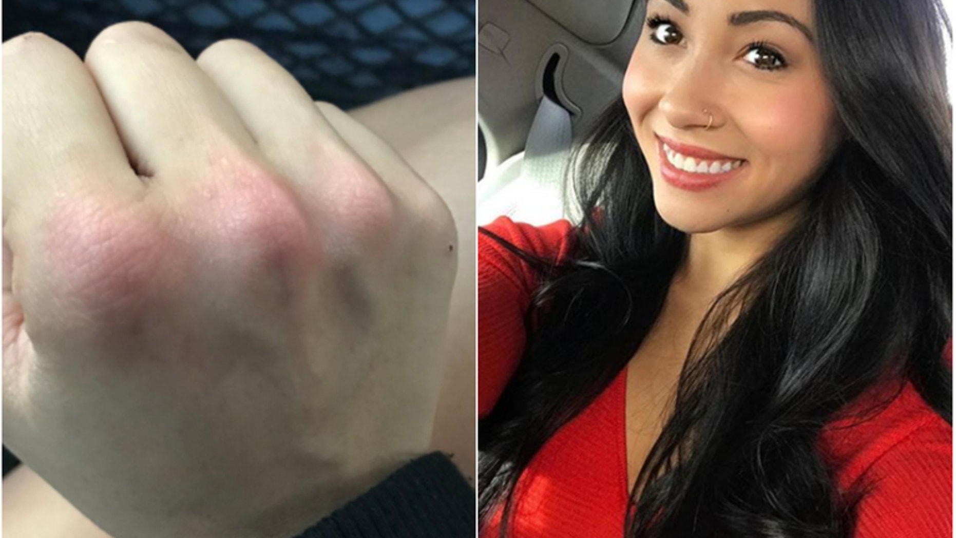 Leanna Carr, of Fort Collins, Colorado, said she punched a man in the face for groping her on the streets of Dublin.