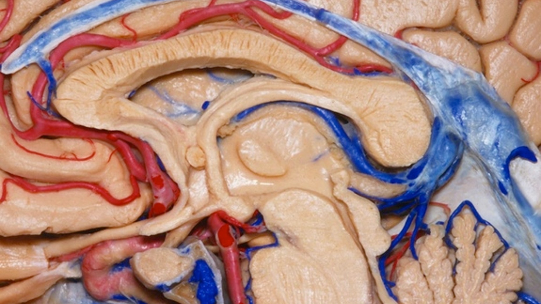 Here, the brain has been neatly sliced in half.