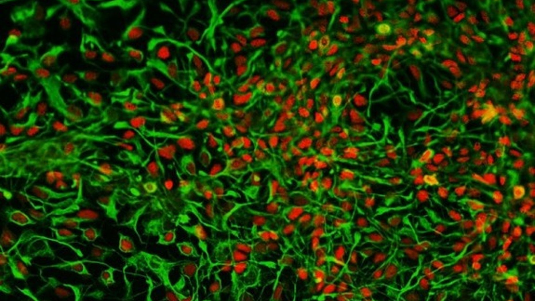 Scientists have reprogrammed kidney cells shed in human urine into brain cells