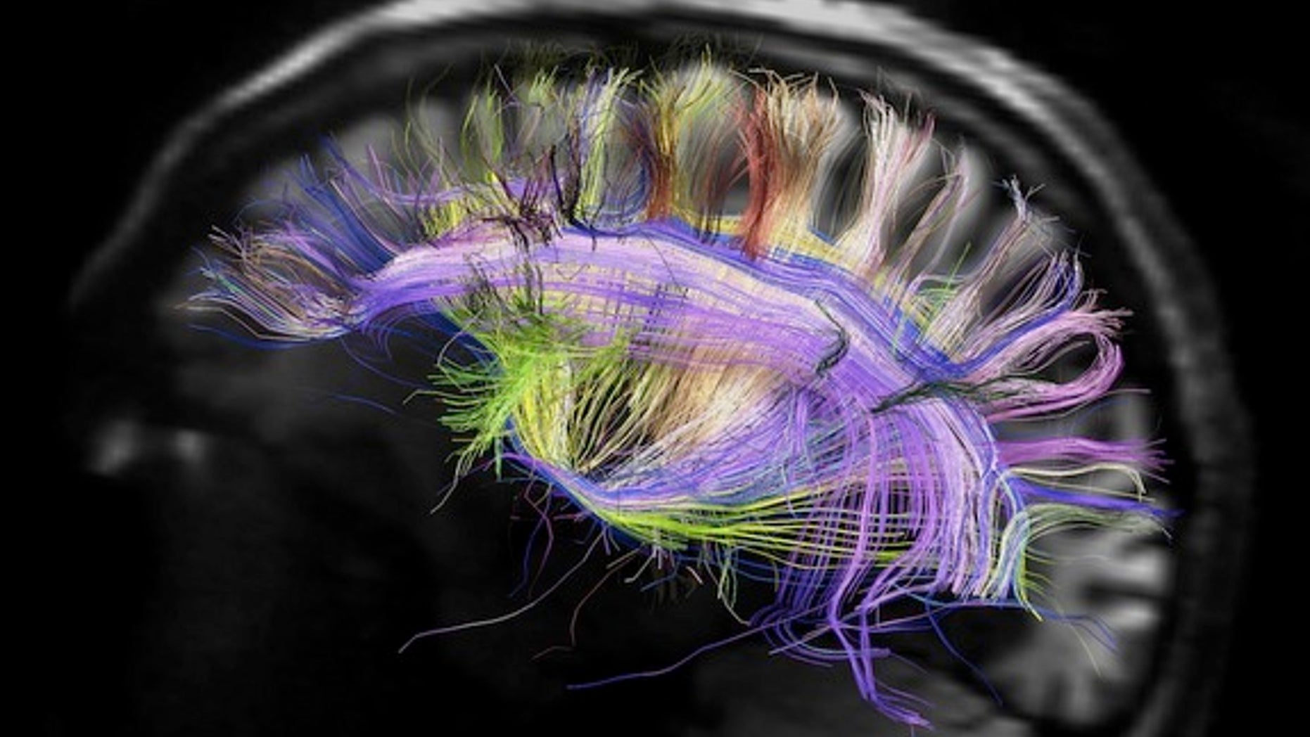 Understanding the human brain will require a knowledge of its wiring and its interactive functioning.