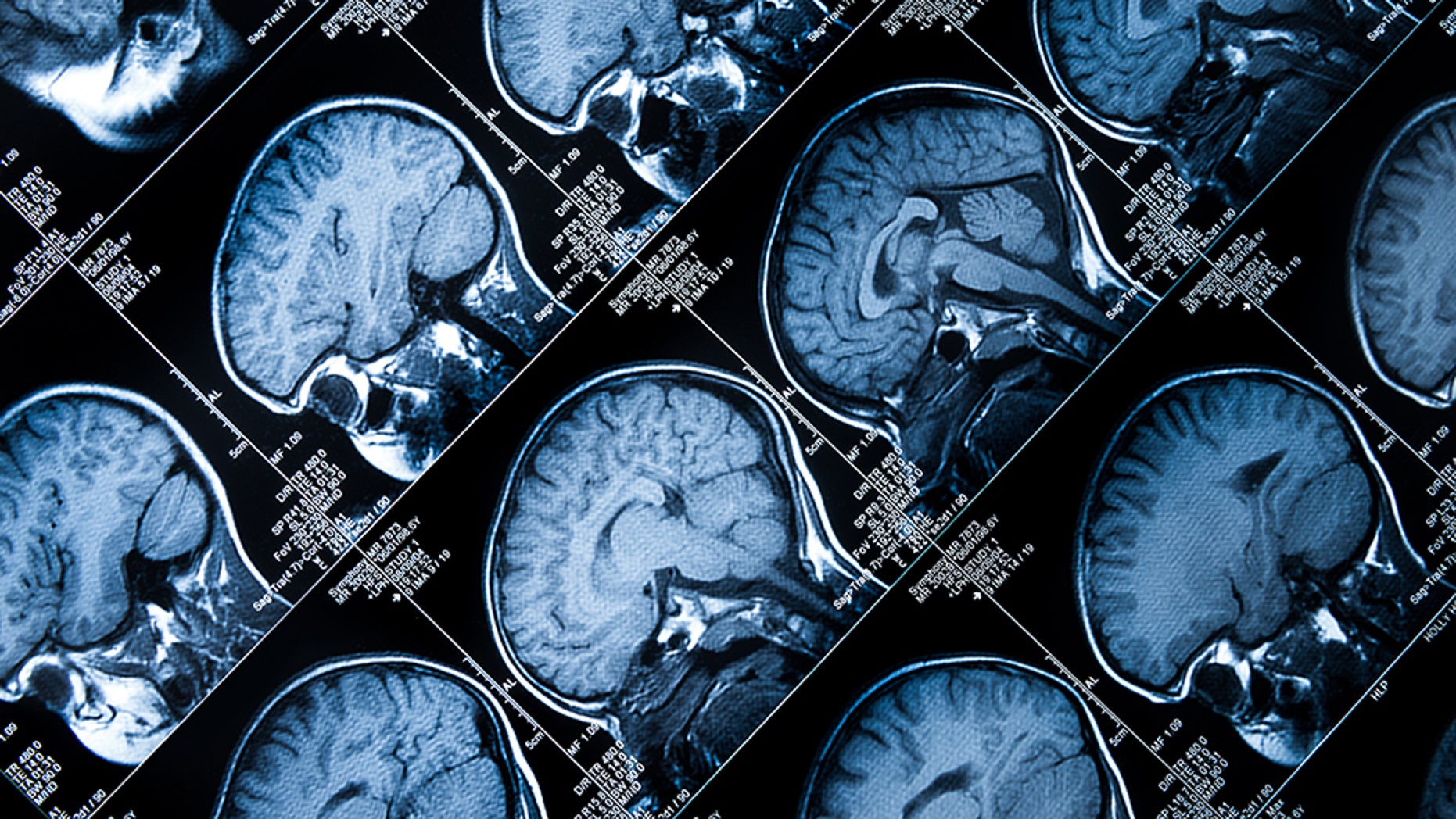 Doctors in Kenya realized two hours into brain surgery they were operating on the wrong patient.
