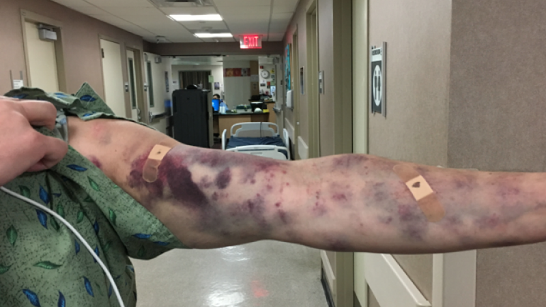 Thomas Jay said he was bit by something that looked like a "cross between a scorpion and a spider."
