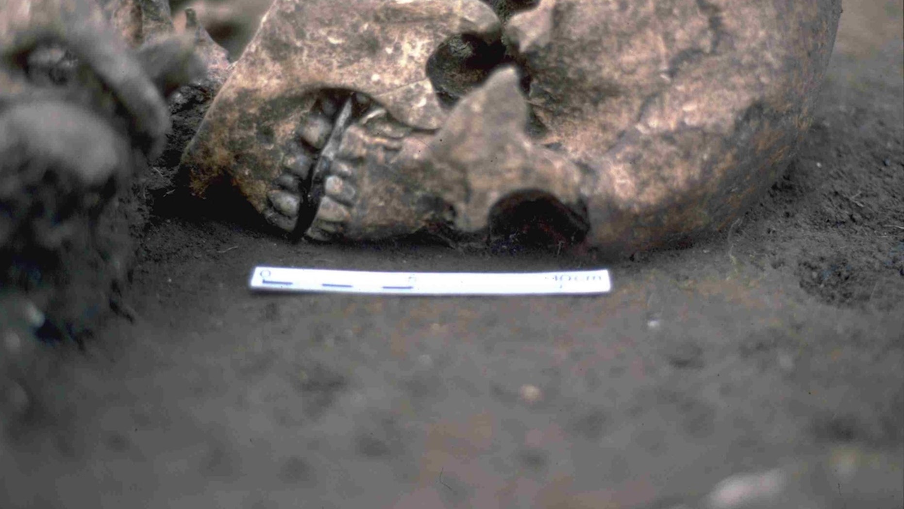 The man's skeleton was found with a flat stone in his mouth, and a new study indicates that his tongue may have been amputated when the man was alive.