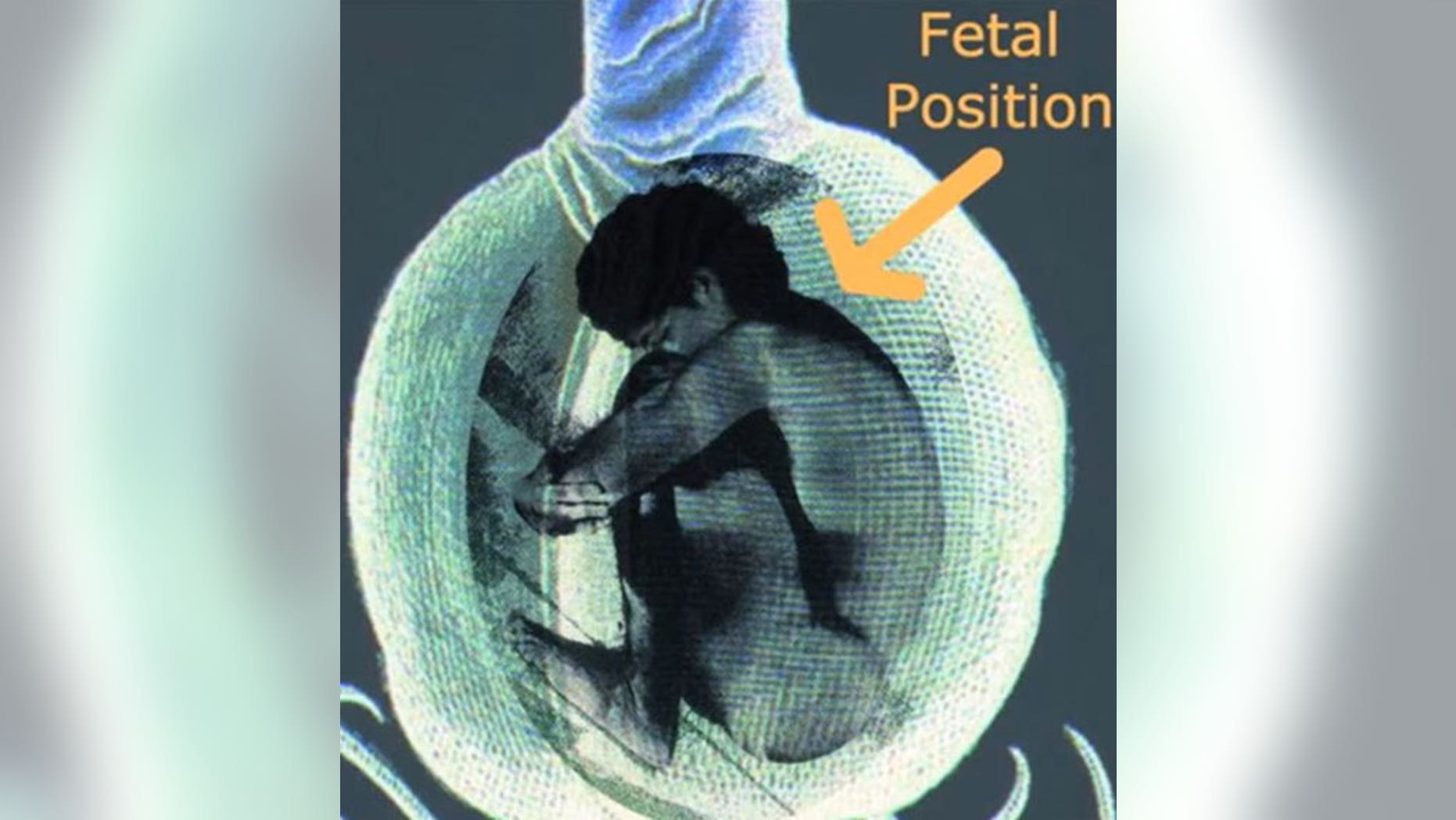 When a person dies, his or her body is placed inside the pod in the fetal position. A pre-selected tree is then planted above ground directly on top of the pod, and roots from the tree absorb nutrients from the decaying body.