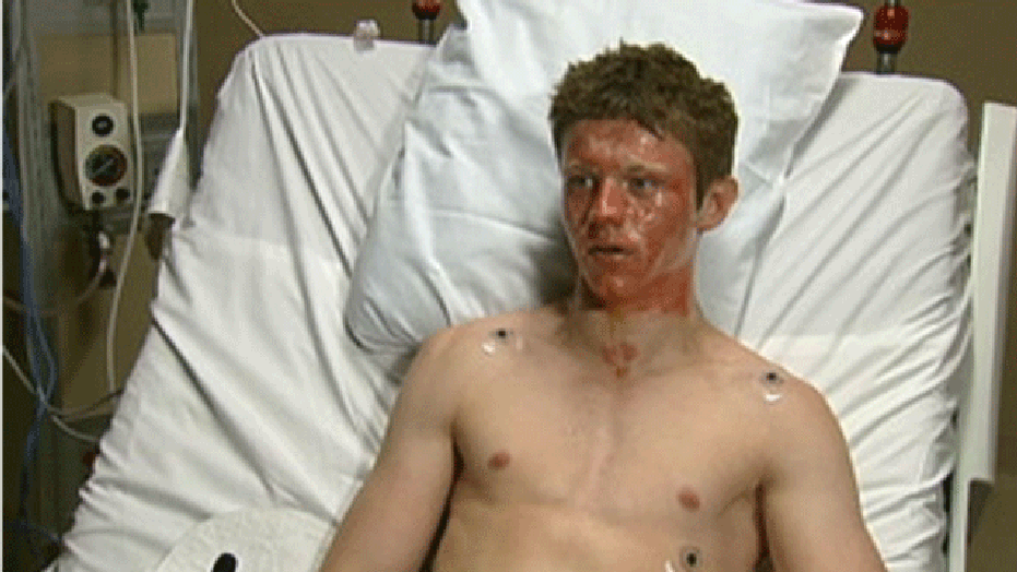 Dec. 1. 2011: Dane Neuberger tells his story from the Hennepin Country Medical Center burn unit. The 15-year-old was burned in a chemical explosion during science class at Maple Grove Junior High School.