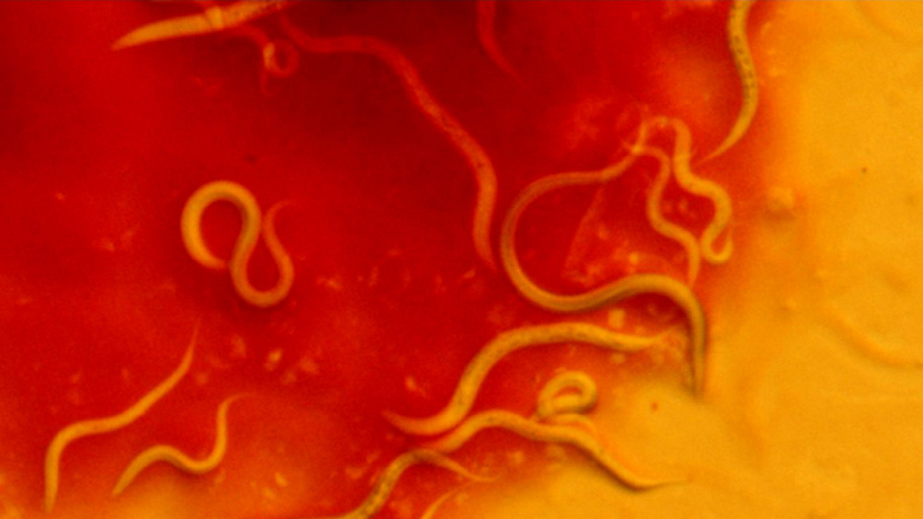 C. elegans crawling on deadly S. marcescens bacteria in a petri dish.