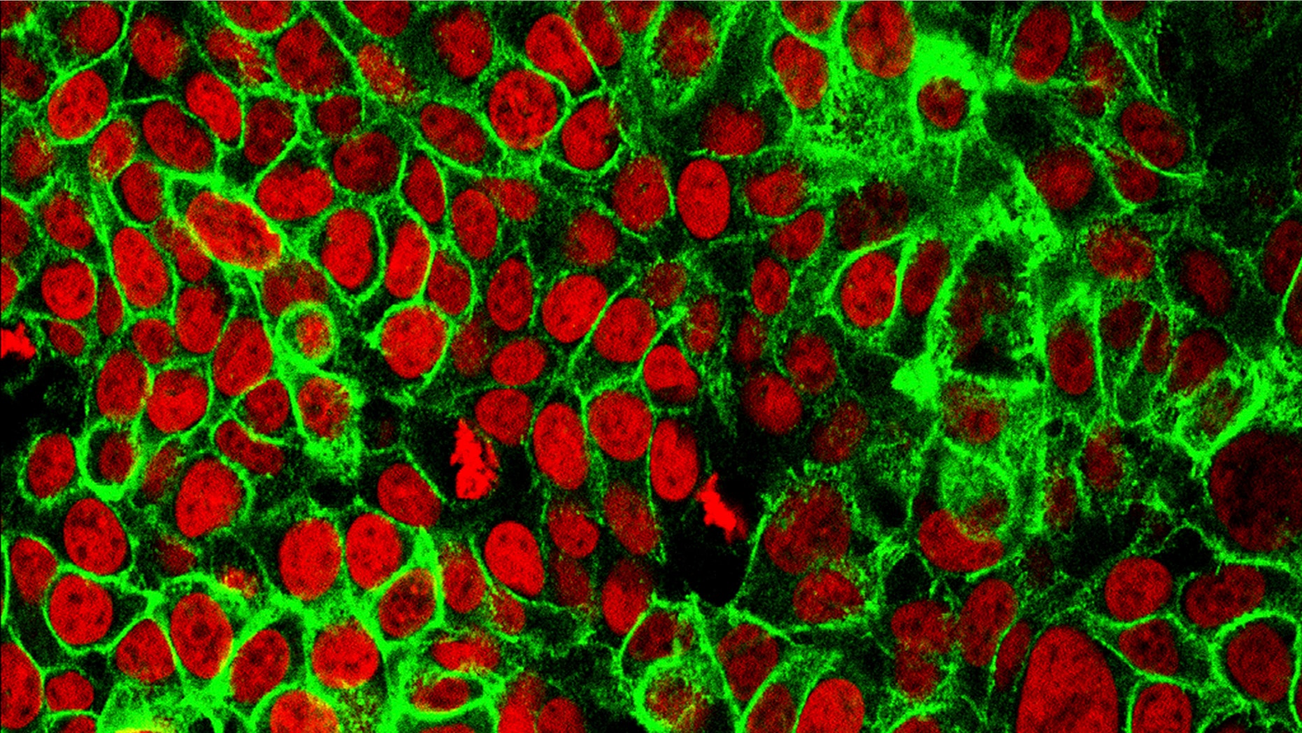 According to new guidelines released on Wednesday, most U.S. adults should begin getting screened for colon cancer when they turn 45.
