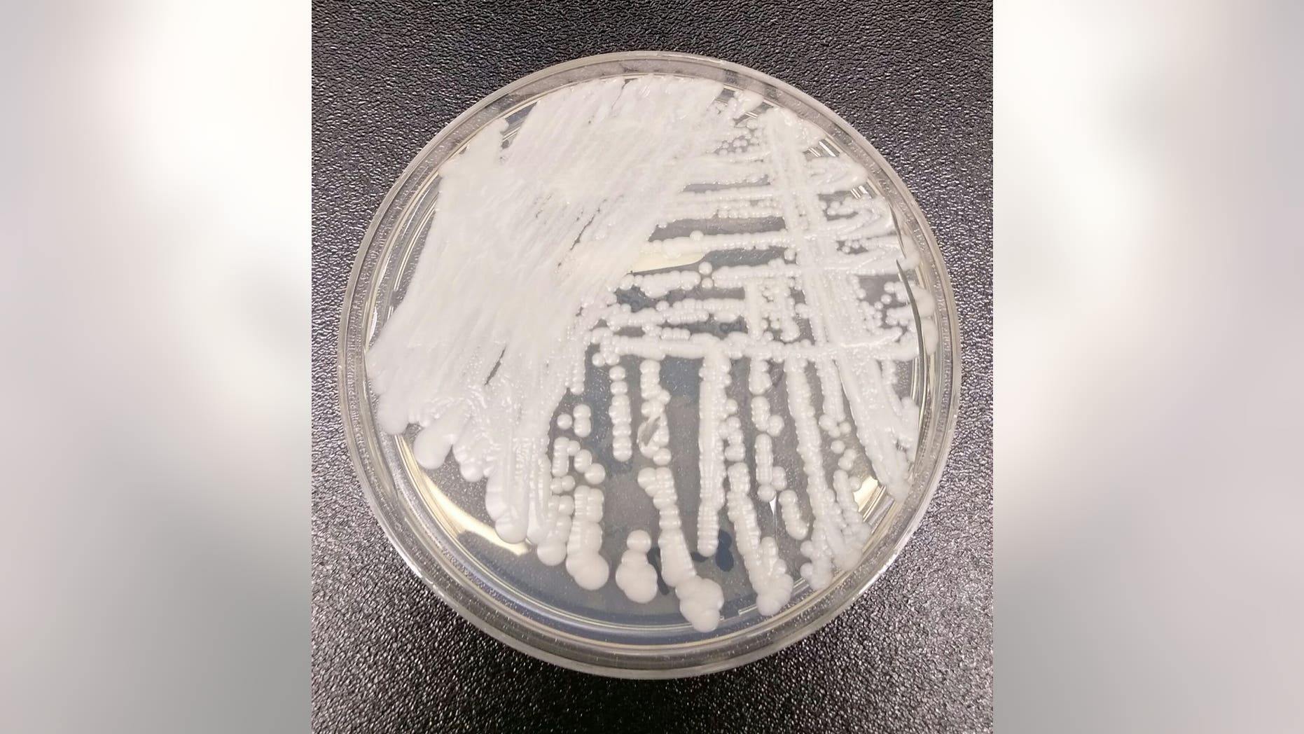 A strain of Candida auris cultured in a petri dish at CDC.