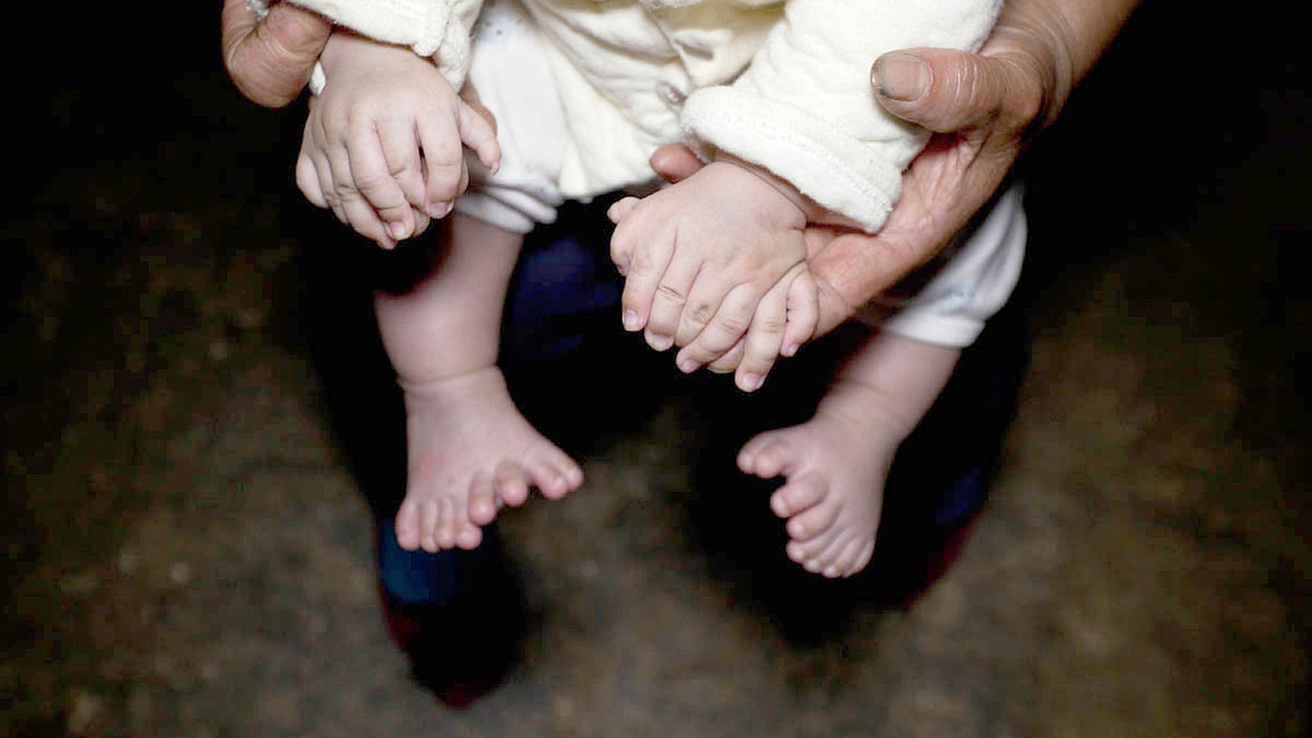 Pic shows: Hong Hong toes.
The poor parents of a young boy in China are asking the public to help cure their son after the child was born with 15 fingers and 16 toes.
The three-month-old boy with polydactylism â a congenital condition characterised by supernumerary fingers or toes â also has two palms, but no thumbs on either hand.
The boy known as Hong Hong was born to two migrant workers from the village of Zhongping, in Pingjiang County of Chinaâs central Hunan Province.
Zou Chenglin, Hong Hongâs dad, said his wife, who works in a factory in Shenzhen City, in southern Guangdong Province, also has polydactylism.
Zou said: "My wife has one extra finger and toe on each of her hands and feet, so we were worried that our child would inherit the condition.
"But after going to three big hospitals in Shenzhen, doctors found no birth defects on our son during scans."
And so it came as a big shock when Hong Hong was born with seven fingers on his right hand and eight on his left, with eight toes on each of his feet.
Zou said the family has since been to a dozen hospitals and the family were relieved to know that Hong Hong can be operated on when he is between six months and a year old.
The surgery could cure the polydactylism and hopefully give the boy a chance at a normal childhood, without the stigma and social pressure and difficulties that would accompany having 15 fingers and 16 toes.
However, the poor migrant worker family will be unable to raise the 100,000 to 500,000 RMB (10,600 to 53,000 GBP) required for the operation and the post-op recovery.
The family is now trying to reach out to local charities and is hoping that the public will extend a helping hand.
But the mum and dad might also be hard-pressed have their case considered a priority, as Hong Hongâs condition is not life-threatening and therefore perhaps not as important as others in the country suffering from more severe diseases.
(ends)