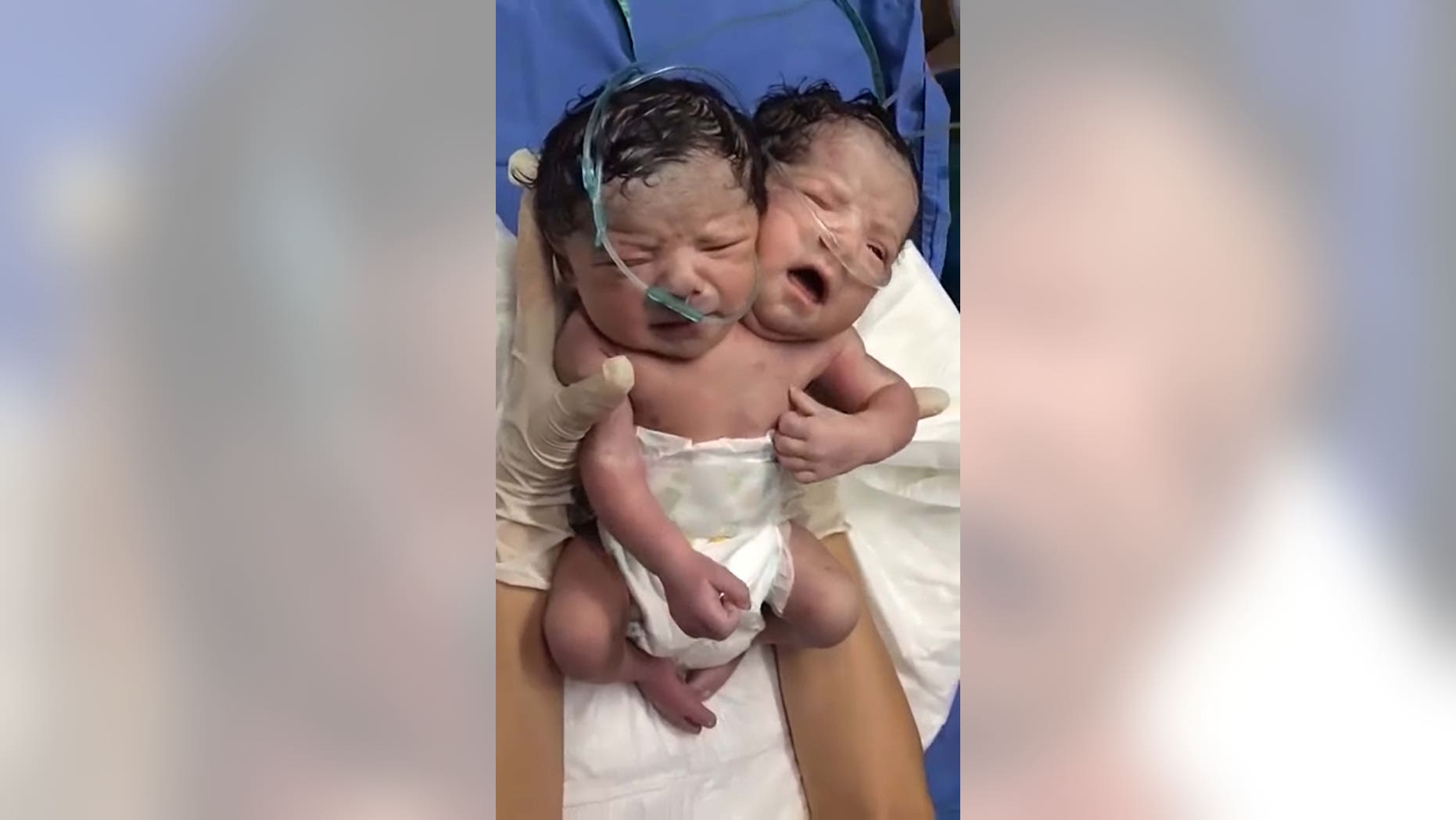 Pic shows: The baby with two heads;
This incredible footage shows a baby with two heads shortly after it was born.
State officials have confirmed the bizarre birth as true after a video made the rounds on social media after being posted by surprised relatives.
Footage shows the newborns wailing just after being born, as they are being held by medics, with tubes leading into their noses.
Authorities have refused to go into detail about the rare case, only confirming that the mother, who has not been identified, is "stable" with the Siamese twins being kept in hospital for observation.
Doctors are said to be looking at a "plan going forward" for the babies.
The rare case happened recently in the city of Ciudad Juarez, in the north-central Mexican state of Chihuahua.
The video was posted online on 6th January and shows the baby wearing a nappy and being held by a medic.
It is reported the baby is male but it is not known if the case was picked up on scans or if the parents knew beforehand that they were having Siamese twins.