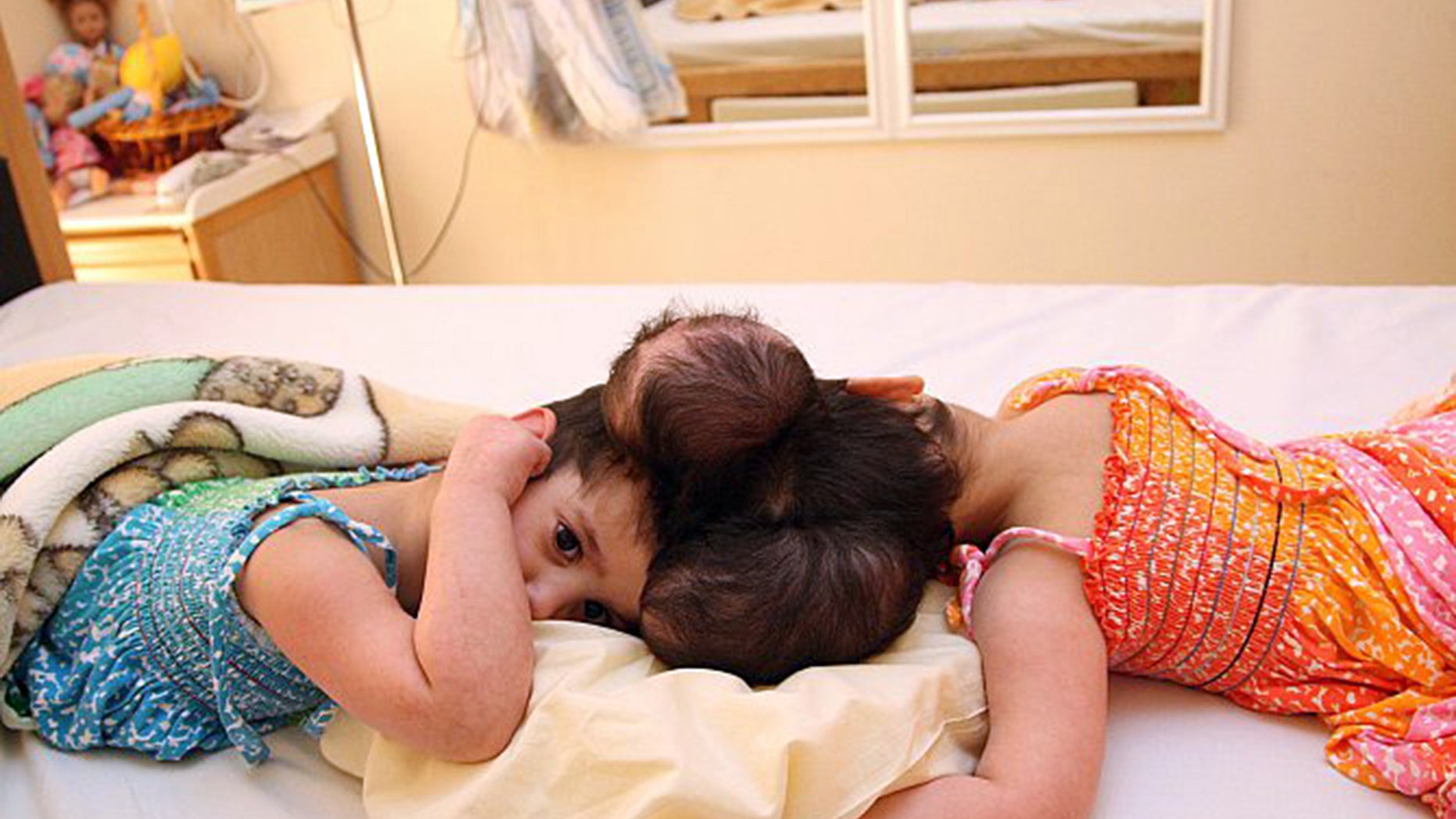 Tuqa and Yakeen are said to be doing well after a 10-hour surgery to separate them.
