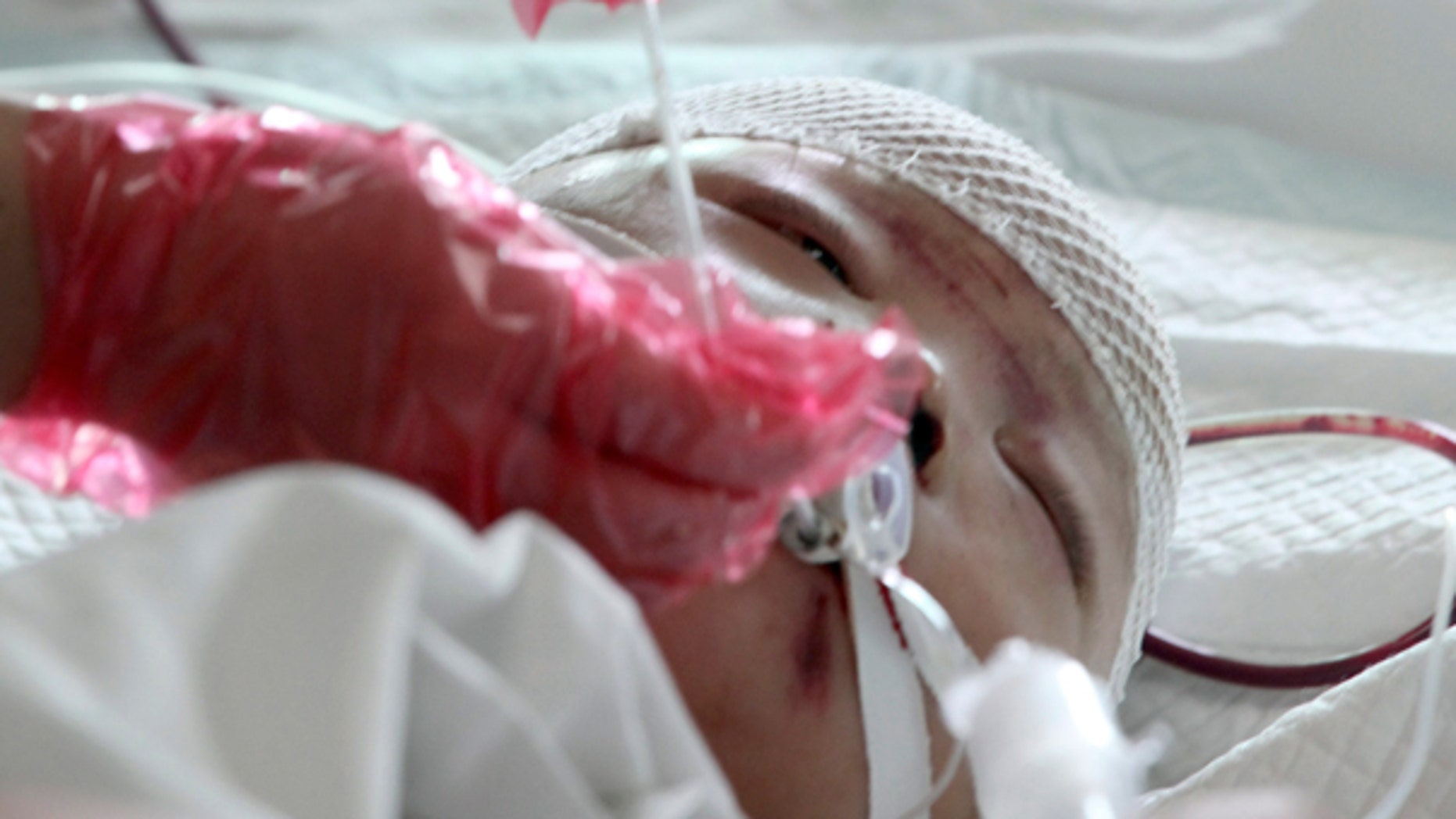 Oct. 16, 2011: A nurse takes care of a two-year-old girl identified as Wang Yue in a hospital in Guangzhou in south China's Guangdong province.
