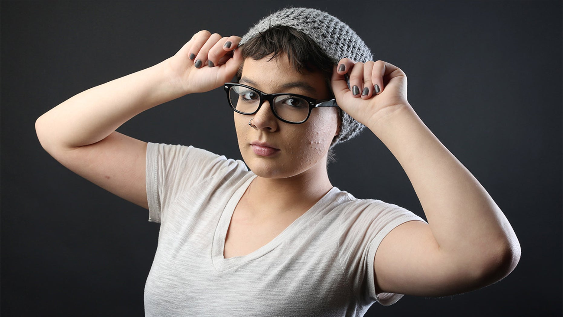 Chloe Terpenning lost her hair in March while undergoing chemotherapy for stage 2 Hodgkin's lymphoma.