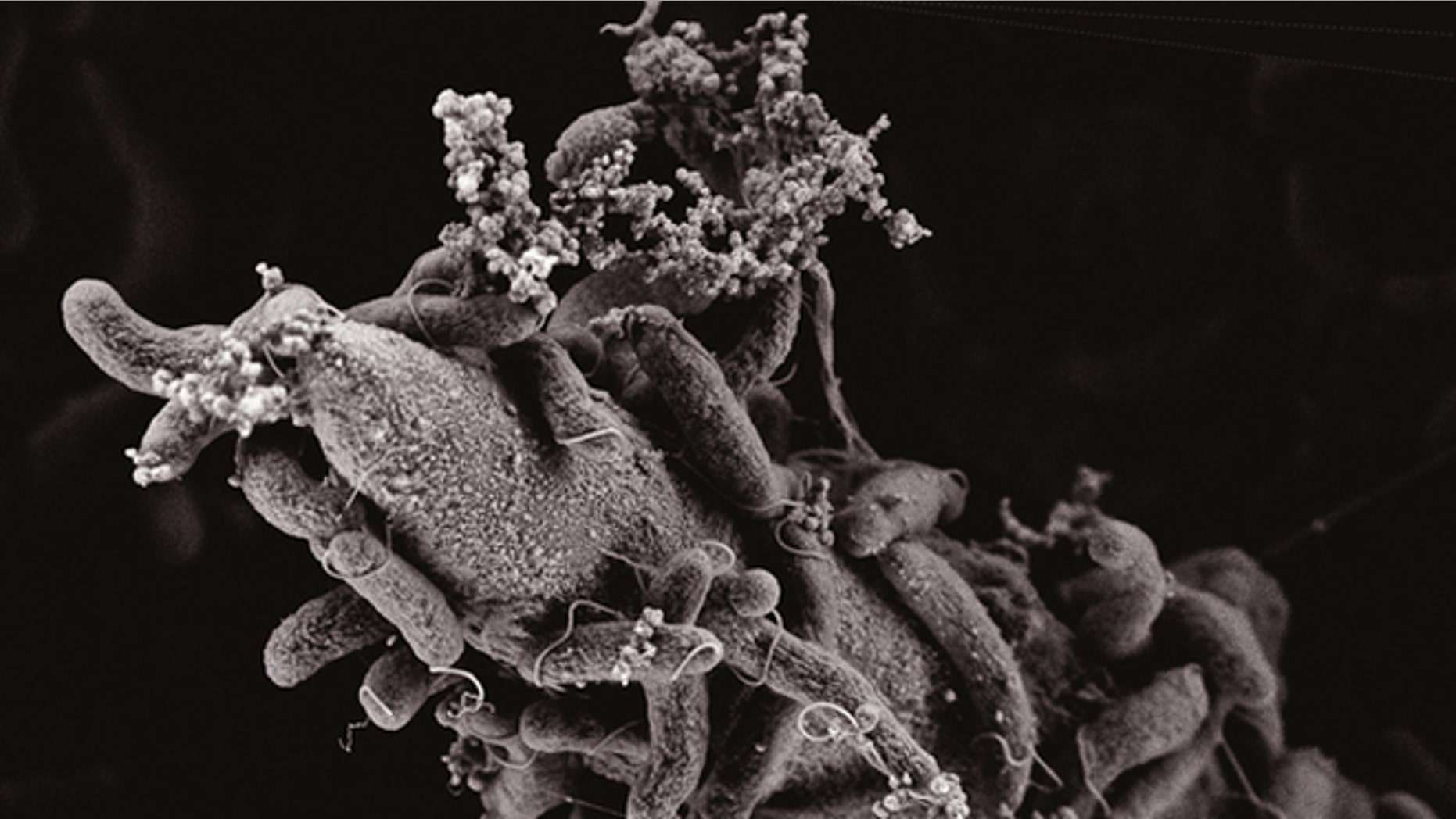 This electron scanning microscopy image show Vibrio cholerae bacteria attached to a chitin surface.