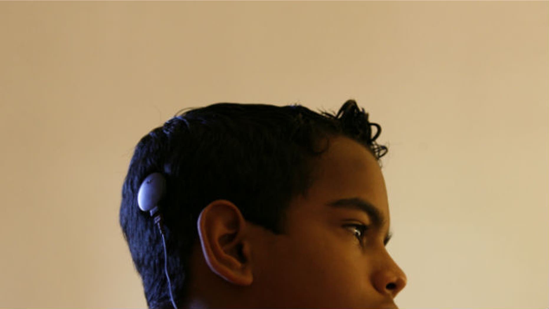 A child with a cochlear implant. REUTERS/Claudia Daut