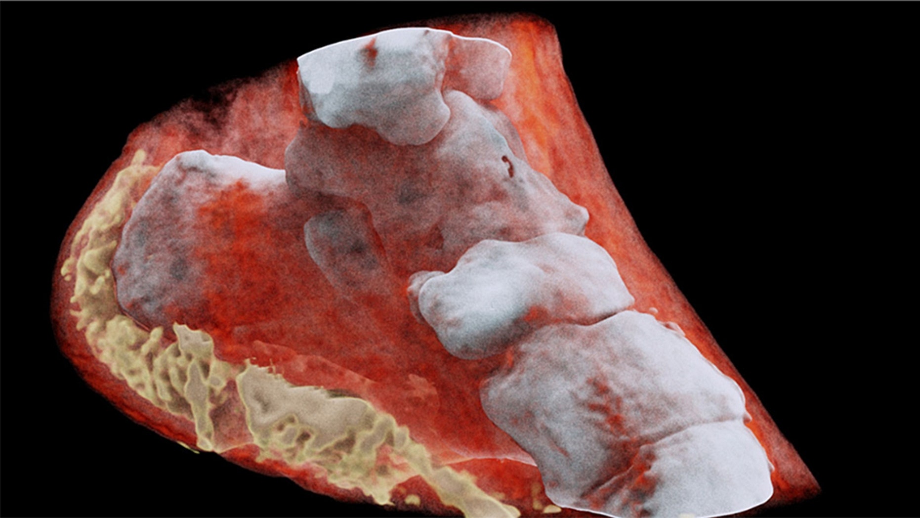 A magnified X-ray captured by CERN's Medipix.