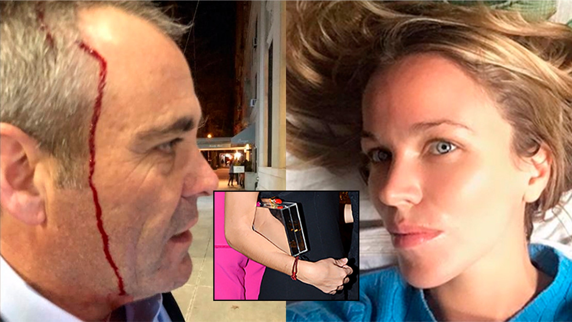 Attorney Matthew Haberkorn alleges that socalite Jacqueline Kent Cooke called his mother a "Jew" and attacked him with a glass purse.