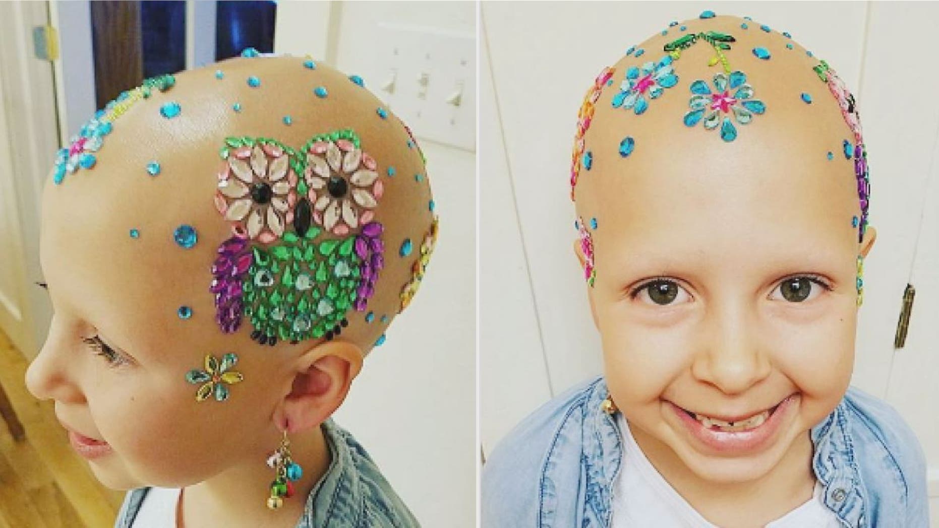 Gianessa Wride of Salem, Utah, began to lose her long brown locks in January.