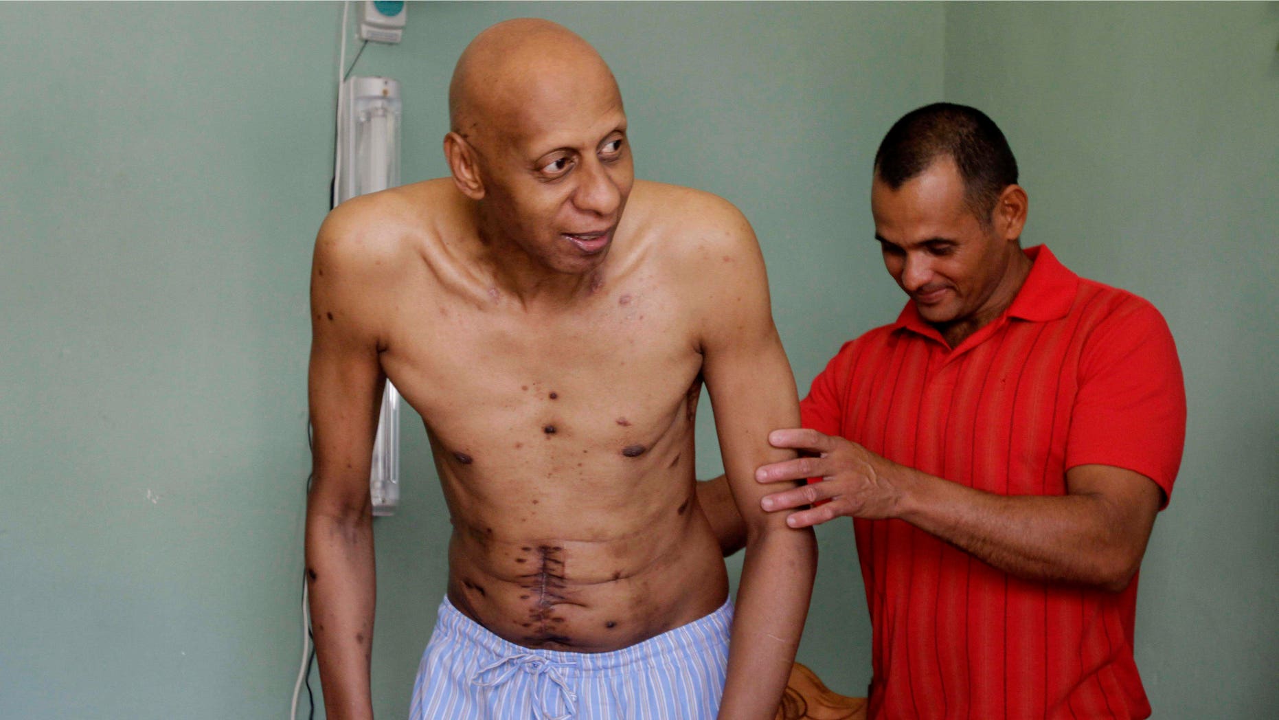 Cuban dissident Guillermo Farinas, left, is helped by medical personnel Ismel Iglesias at his home in Santa Clara, Cuba, Thursday Oct. 21, 2010. The European Parliament announced Thursday it has awarded its annual human rights prize to Farinas. The 48-year-old psychologist and freelance journalist spent three weeks in the hospital this year after a 134-day hunger strike to force the government to release opposition leaders jailed in 2003. According to Farina's spokesperson Liset Zamora, the scar on Farina's naval area is from gallbladder surgery that took place after his hunger strike and the other scars on his chest are from drainage holes related to the surgery. (AP Photo/Franklin Reyes)