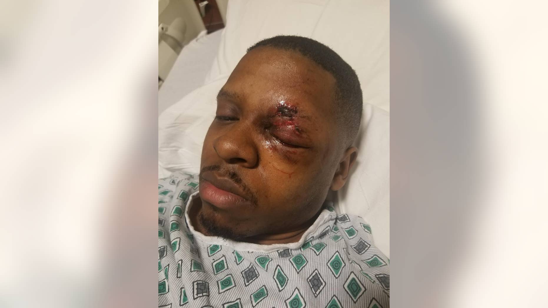 Rasaan Urquhart, 25, is warning others to be safe around fireworks on the Fourth after going blind in one eye after an incident in February.