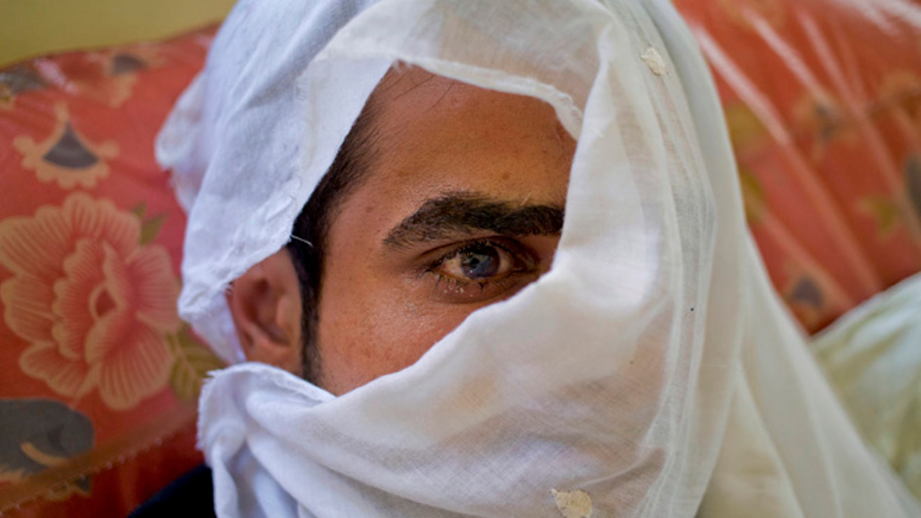 JULY 13: Huzaif Nazir, whose eye was damaged after Indian government forces fired pellets at him during a protest covers his face with a white cloth to hide his identity as he rests on a hospital bed in Srinagar, Indian controlled Kashmir.