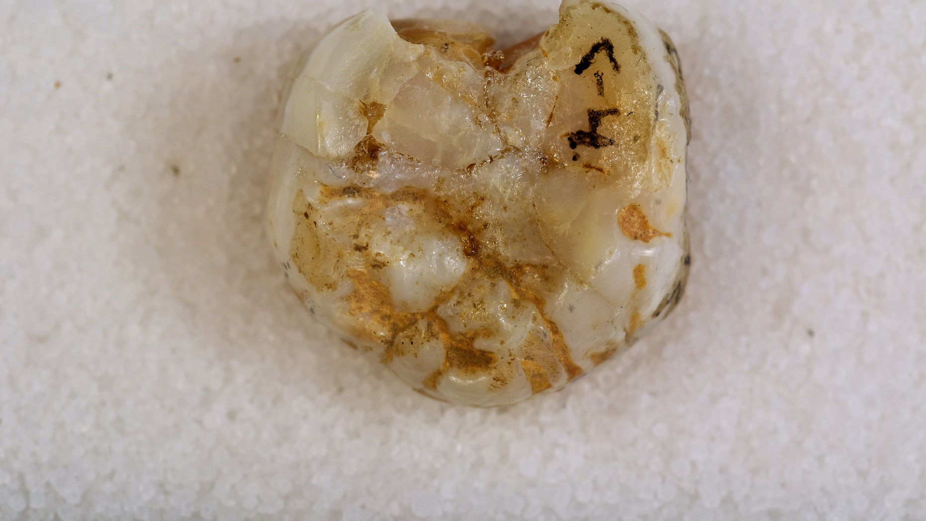 Prehistoric tooth excavated from the Denisova cave in Siberia's Altai Mountains in 2010 (Dr. Bence Viola, Max-Planck-Institute of Evolutionary Anthropology)