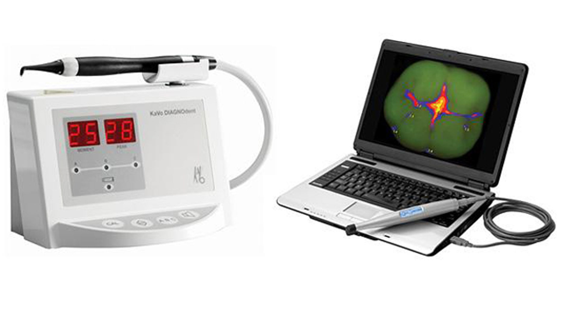 Emerging devices like Kavos popular Diagnodent (left) and Air Techniques Spectra (right) have been accused of helping dentists drum up business with unnecessary drillings.