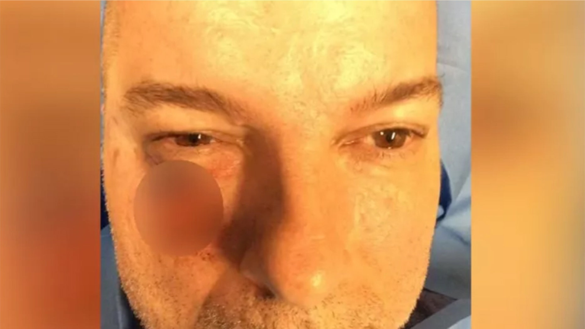 Shawn Montgomery visited the dermatologist after his dentist spotted discoloration on his face.