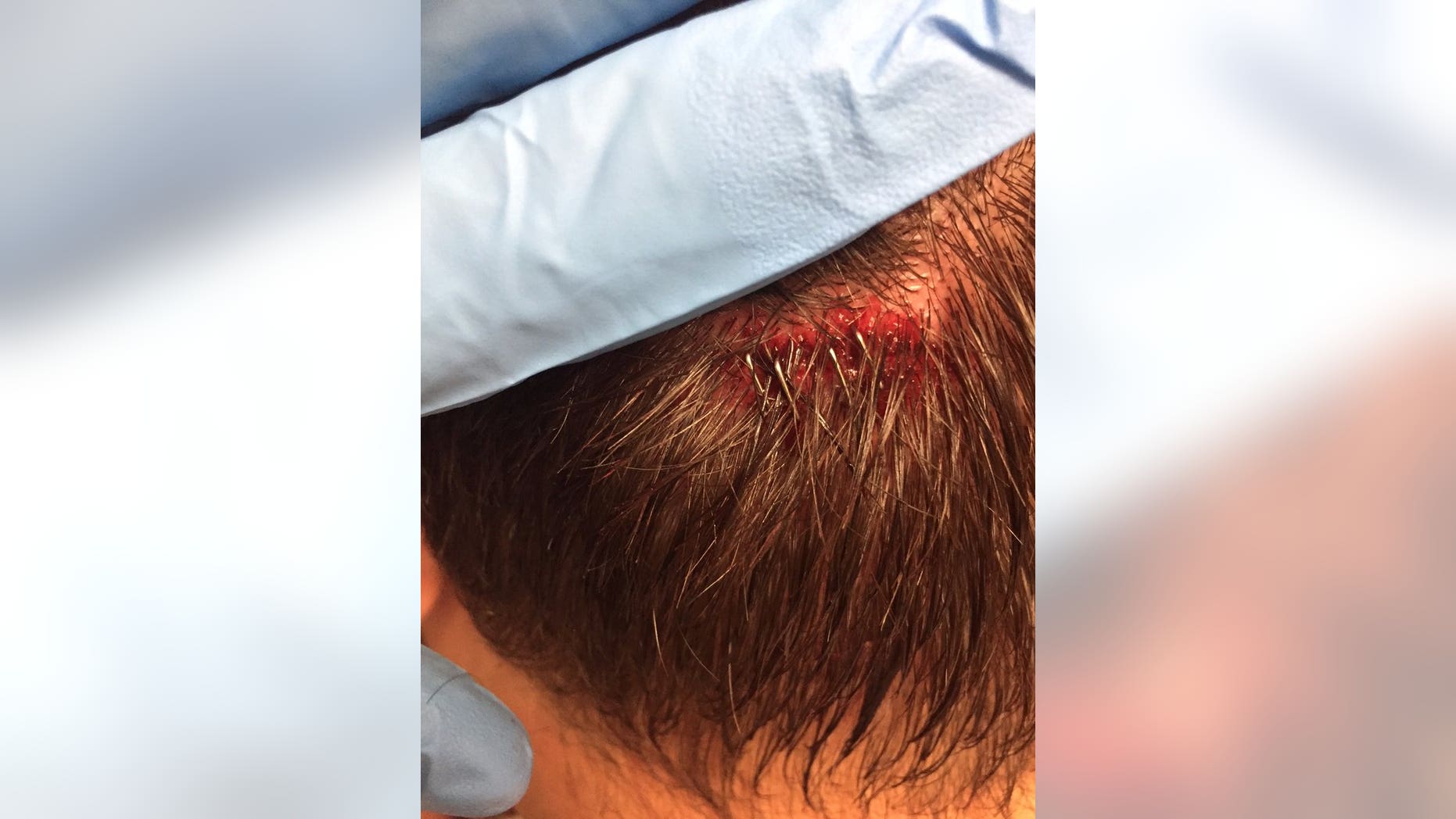 A photojournalist for CBS 6 WTVR in Richmond, Virginia, was reportedly attacked by anti-racist protesters Sunday Night