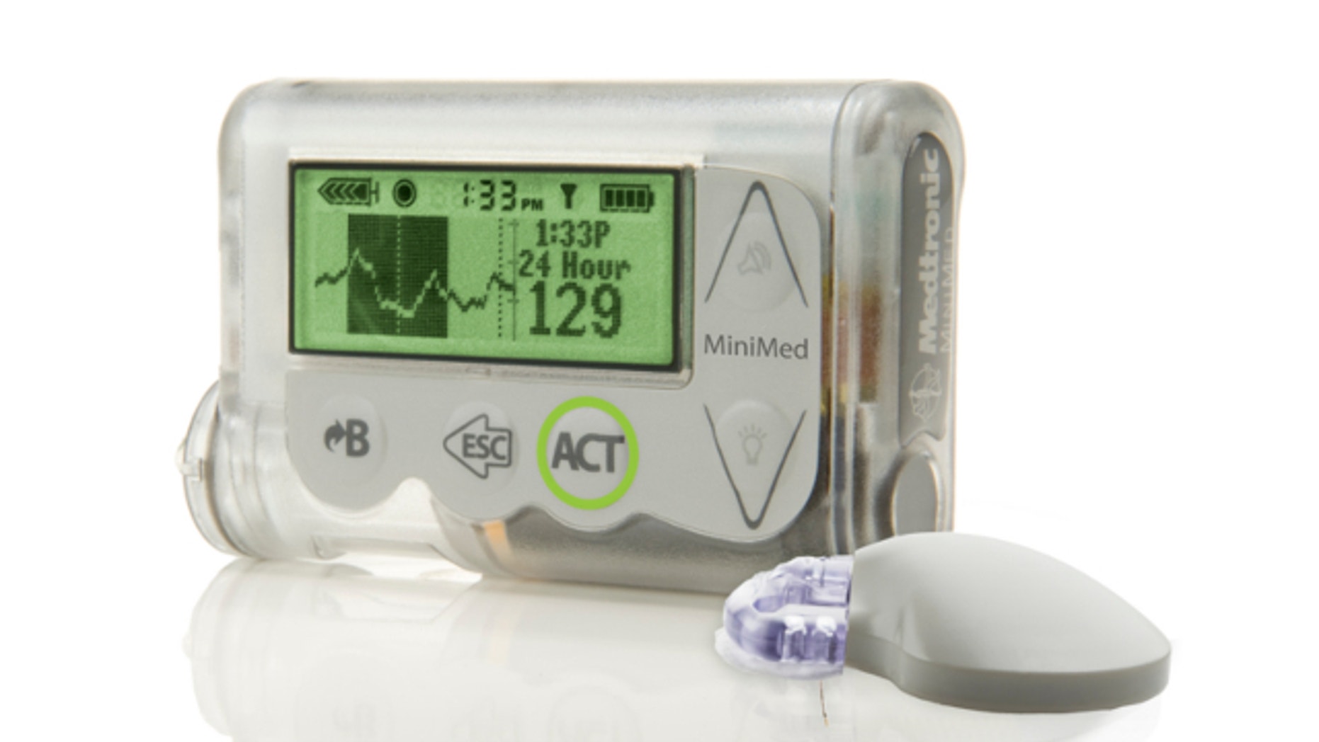 October 2012: This image provided by Medtronic shows the MiniMed Integrated System device, which doctors are reporting as a major step toward an "artificial pancreas."