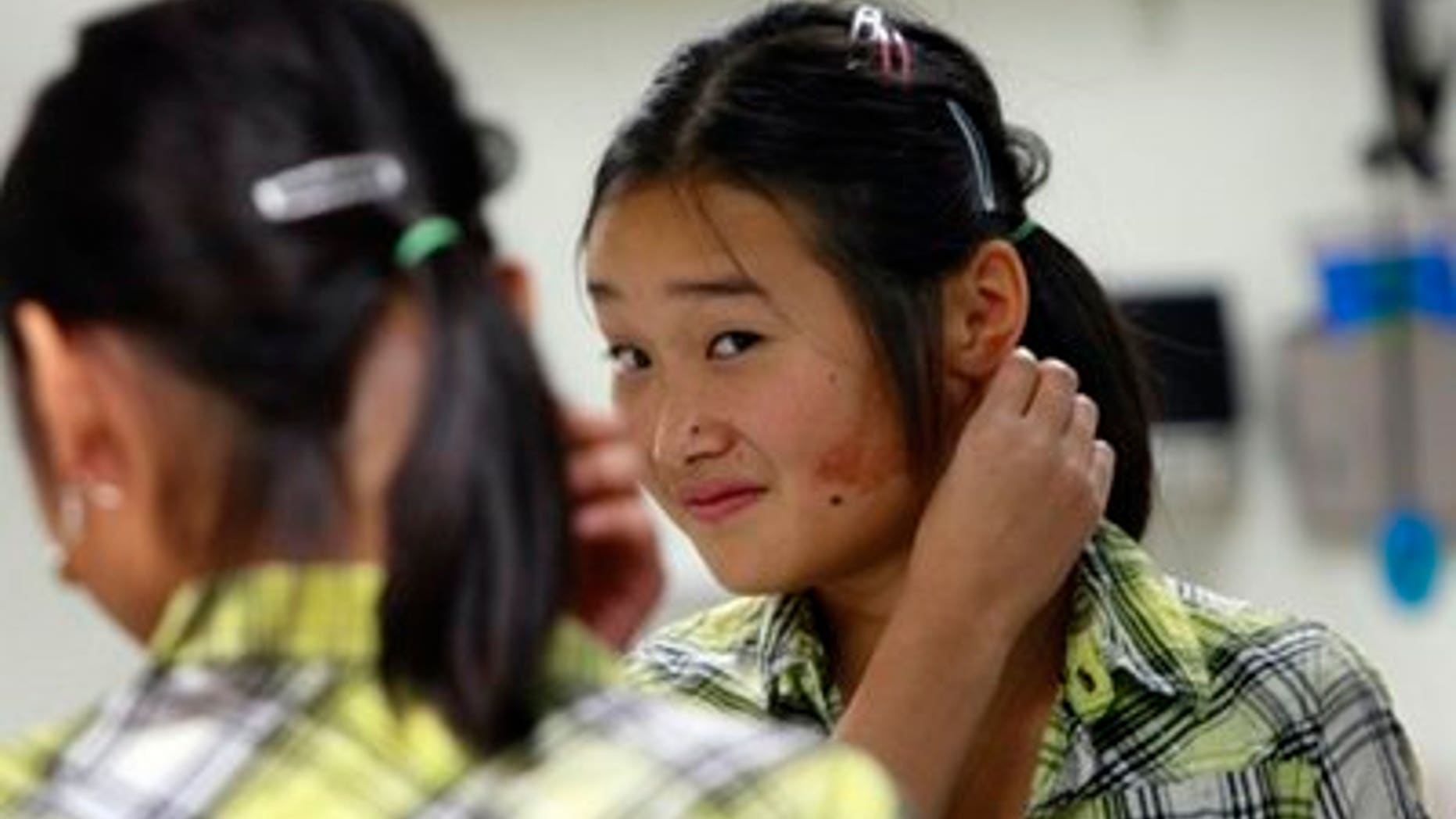 In this Wednesday, Nov. 24, 2010, photo Elise Lutz looks into a mirror and admires her new prosthetic ear at the Anaplastology Clinic in Durham, N.C. "It kind of took forever, but it was worth it," says Elise, 14, as she headed to show her transformation to her dad and sisters. "I'm so excited, I'm more than 100 excited." (AP Photo/Gerry Broome)