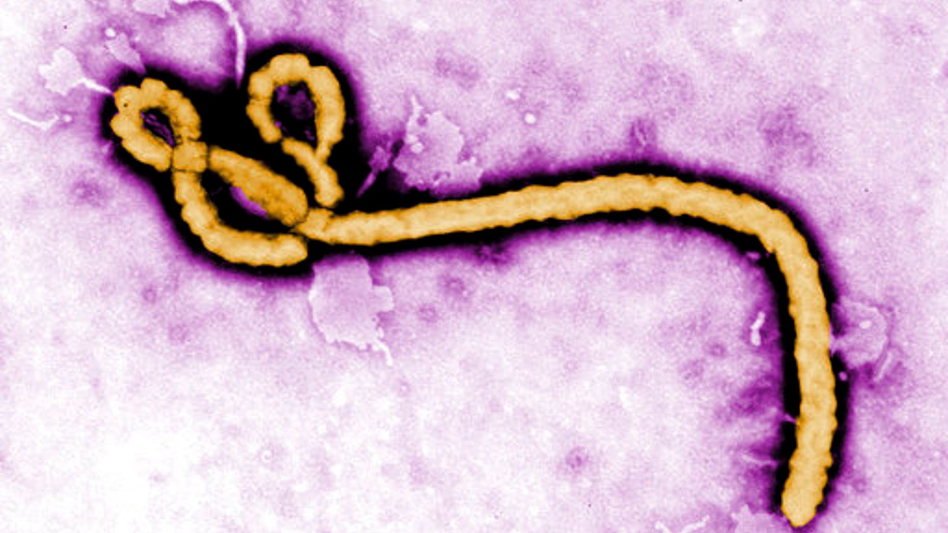 Health authorities are investigating nine suspected cases of Ebola in a remote corner of northern Congo, including two deaths, the country's health minister said Friday May 12, 2017. (Frederick Murphy/CDC via AP, File)
