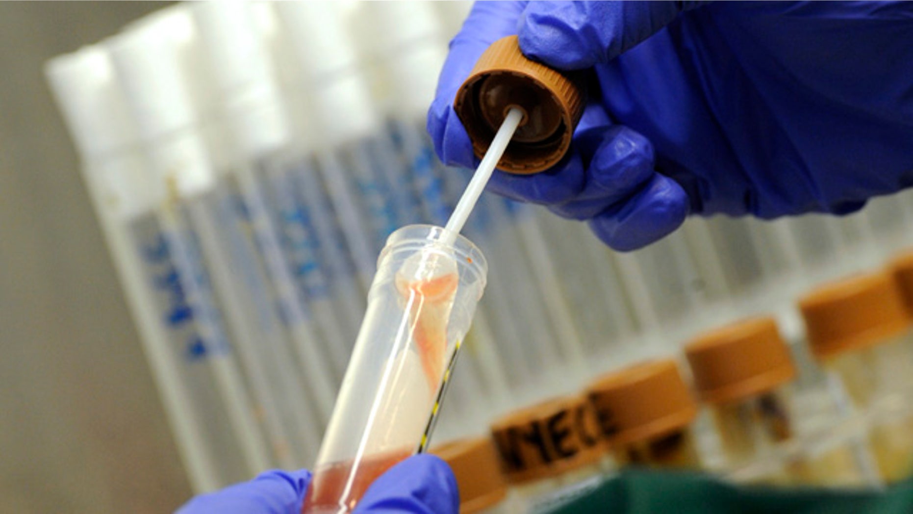 An employee examines a stool sample for EHEC bacteria (bacterium Escherichia coli) strains in the microbiological laboratory of the 'Universitaetsklinikum Hamburg-Eppendorf ' (University Cllinic Eppendorf- UKE) in the northern German town of Hamburg, June 2, 2011.