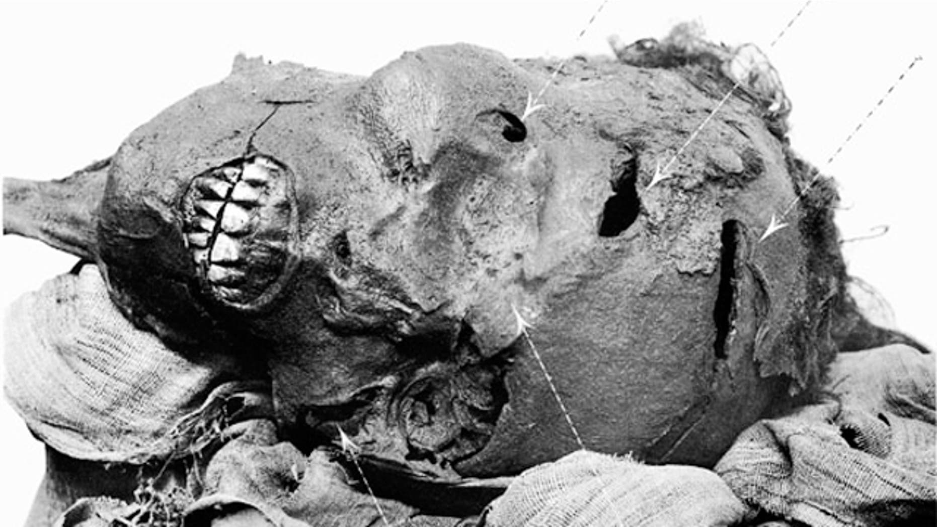 Pharaoh Seqenenre Tao II died from multiple ax wounds. He may have been killed in battle, executed afterwards, or possibly assasinated. A long dagger believed to belong to his son Kamose has evidence of wear and tear, suggesting that he used it to avenge his father's death.