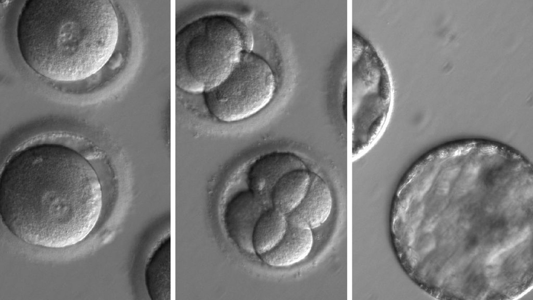 This sequence of images shows the development of embryos after co-injection of a gene-correcting enzyme and sperm from a donor with a genetic mutation known to cause hypertrophic cardiomyopathy. (OHSU)