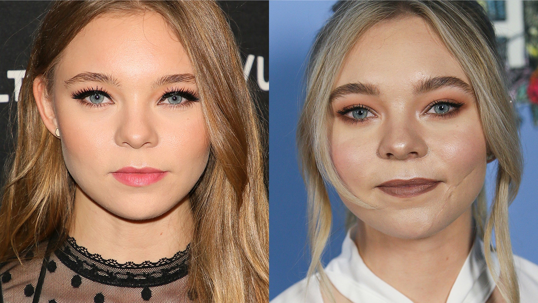 Actress Taylor Hickson is suing a protection company after she says an on-set injury left her disfigured.