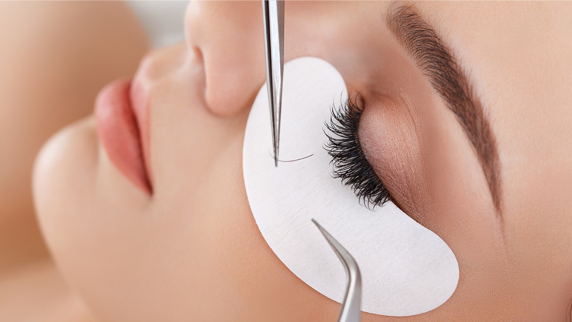 A woman's eyelash extensions gave her an infection and caused her real lashes to fall out
