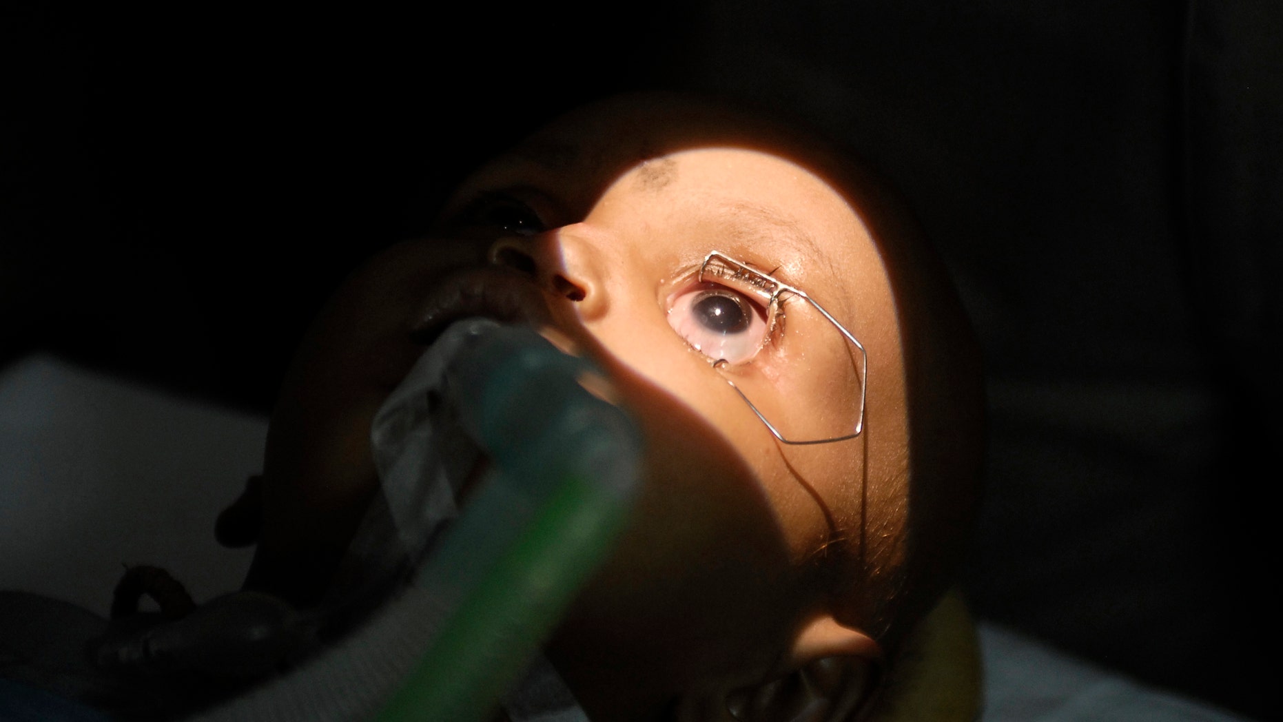 File photo - 15-month-old Tanishka has her eyes examined inside a operation theatre during a free treatment for poor patients to mark World Retinoblastoma Awareness week in the southern Indian city of Hyderabad May 12, 2010. Retinoblastoma is the most common primary ocular malignancy (eye cancer) of childhood, a doctor said. (REUTERS/Krishnendu Halder)