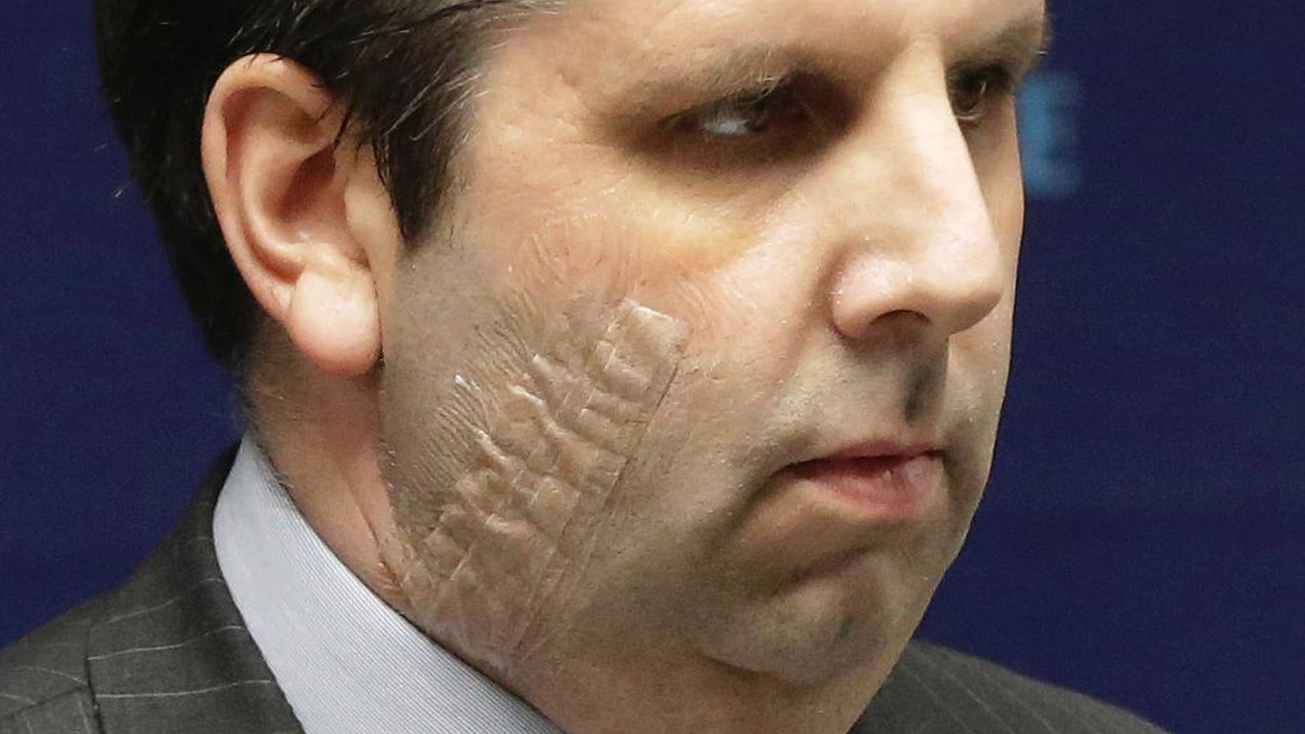 FILE - In this Tuesday, March 10, 2015, file photo, U.S. Ambassador to South Korea Mark Lippert listens to a question during a press conference before being discharged from Severance Hospital in Seoul, South Korea. South Korean prosecutors on Wednesday, April 1, 2015, indicted Kim Ki-jong, 55, who slashed Lippert in Seoul last month on charges of attempted murder. (AP Photo/Ahn Young-joon, File)