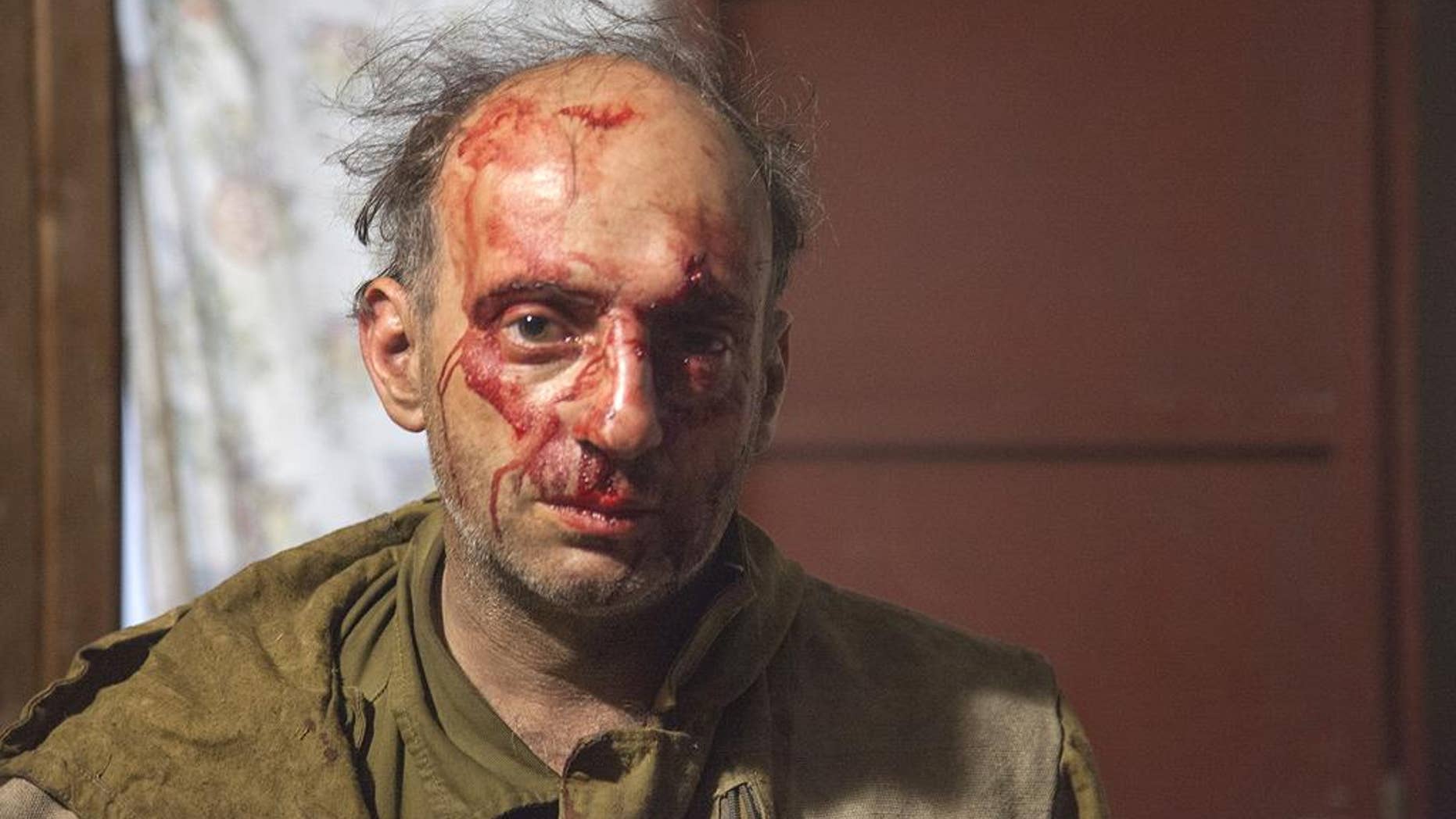 In this handout photo released by Greenpeace, Michael Kreindlin, a Greenpeace Russia staff member, poses for a photo after being beaten by attackers in Mogukorovka village, the Kuban region, 1120 kilometers (700 miles) south from Moscow, Russia, Friday, Sept. 9, 2016. Masked men armed with guns, knives and stun grenades have attacked a camp of volunteer firefighters who came to southern Russia to help to put out forest fires. (Maria Vasileva/Greenpeace Photo via AP)