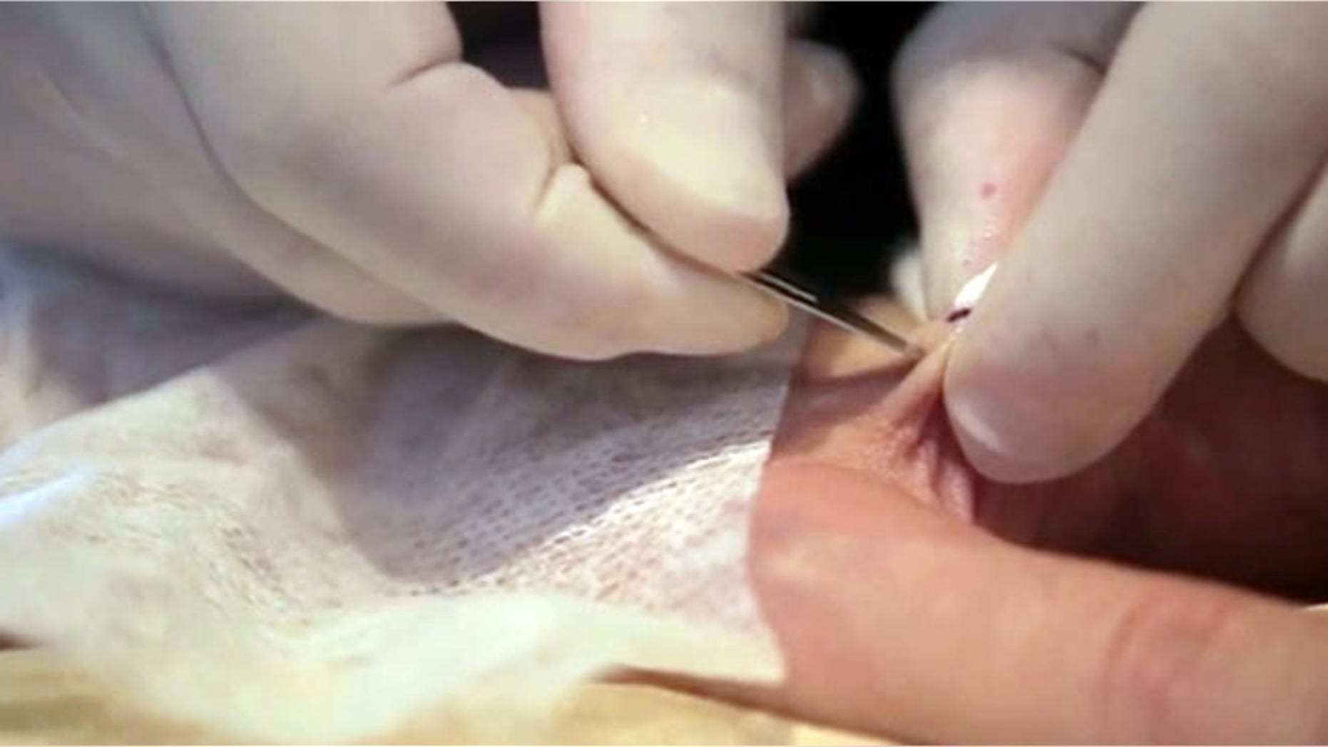 A tattoo artist implants a small RDIF chip into a man's hand.
