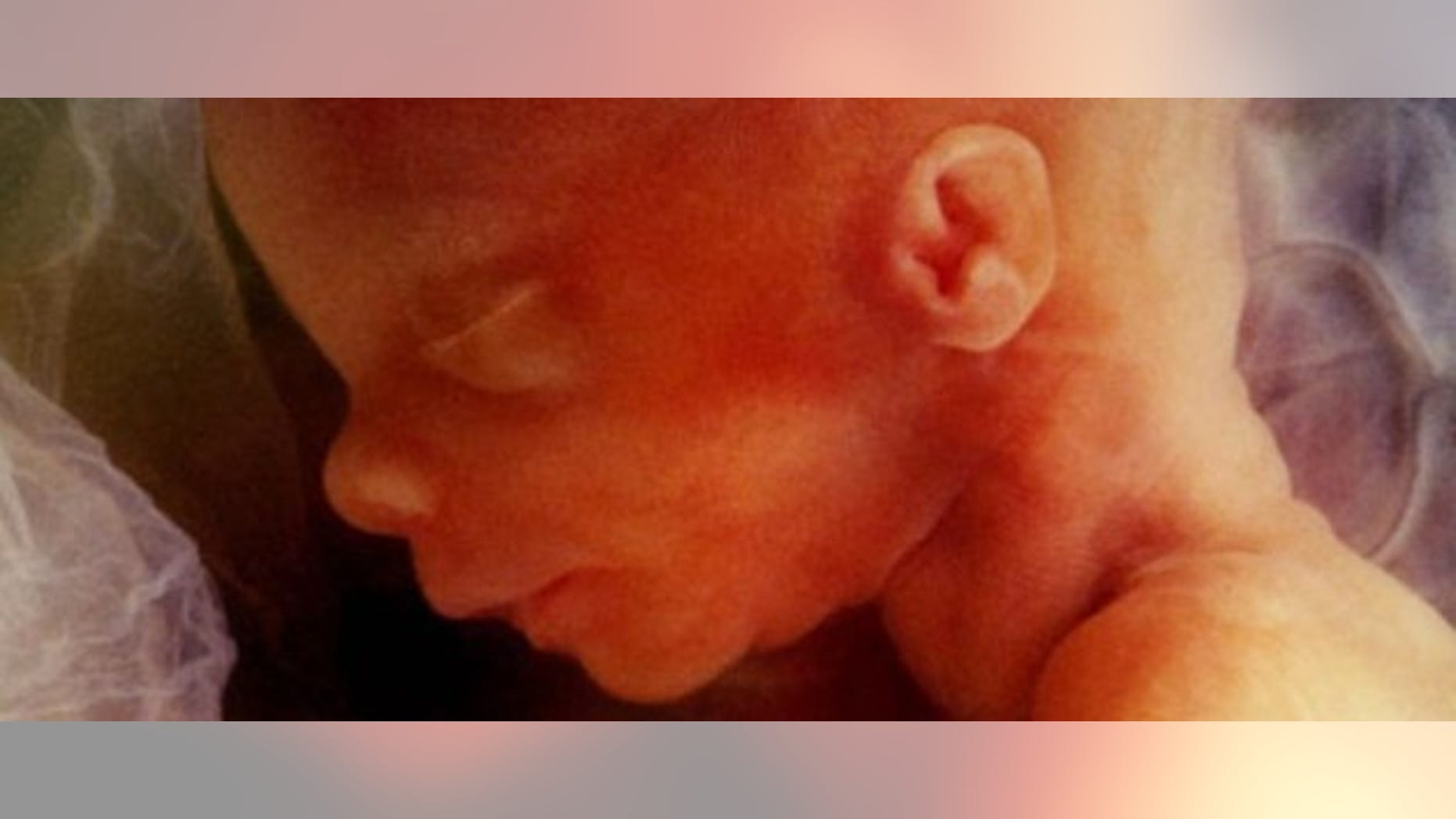 fetus in womb. Photo: Getty Images