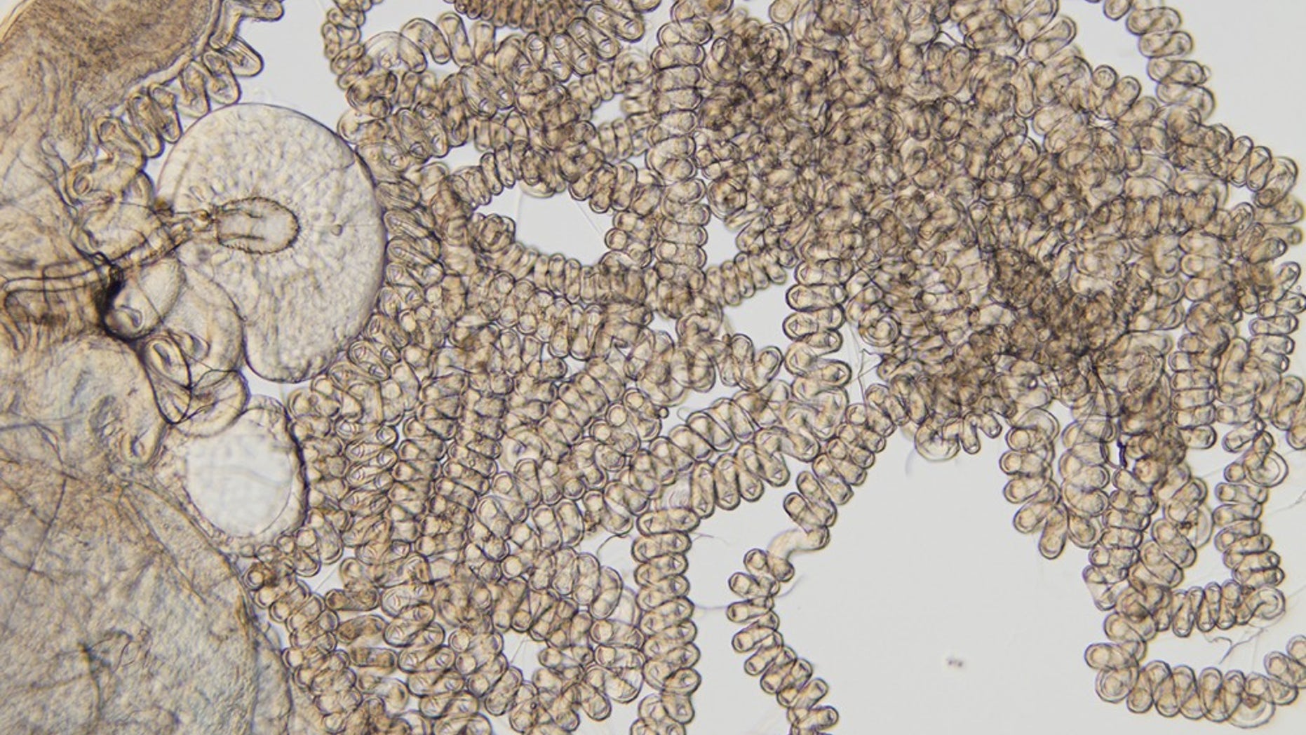 The sperm-storage tubule of the fruit fly Drosophila bifurca is nearly 8 centimeters long. The size of this organ drives the size of mega sperm in males.