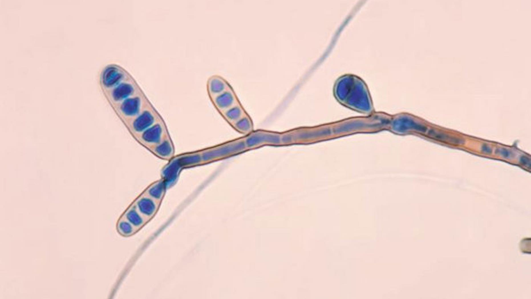 The fungus Exserohilum, pictured, has been found in some of the patients affected by the meningitis outbreak.