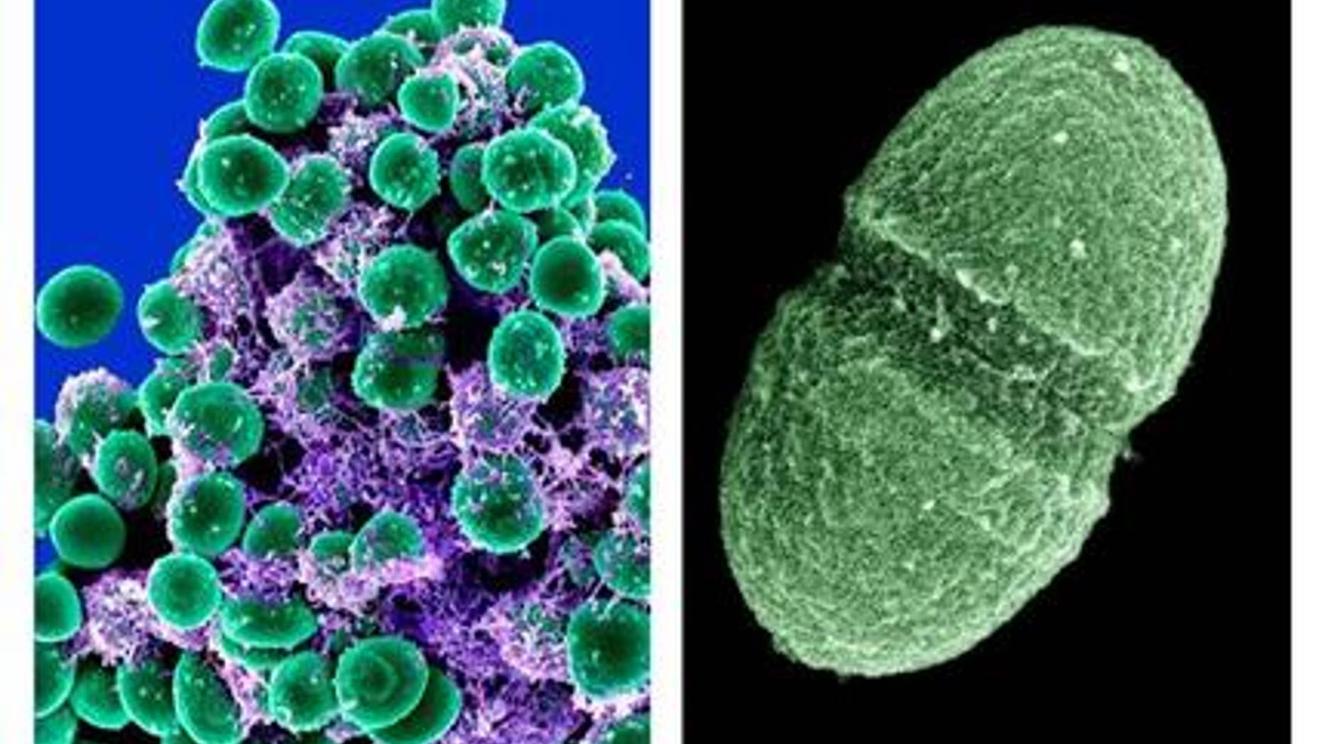 At left, undated handout image provided by the National Institute of Allergy and Infectious Diseases (NIAID) shows a clump of Staphylococcus epidermidis bacteria (green). At right, undated handout image provided by the Agriculture Department showing the bacterium, Enterococcus faecalis. (AP Photo/NIAID, Agriculture Department)