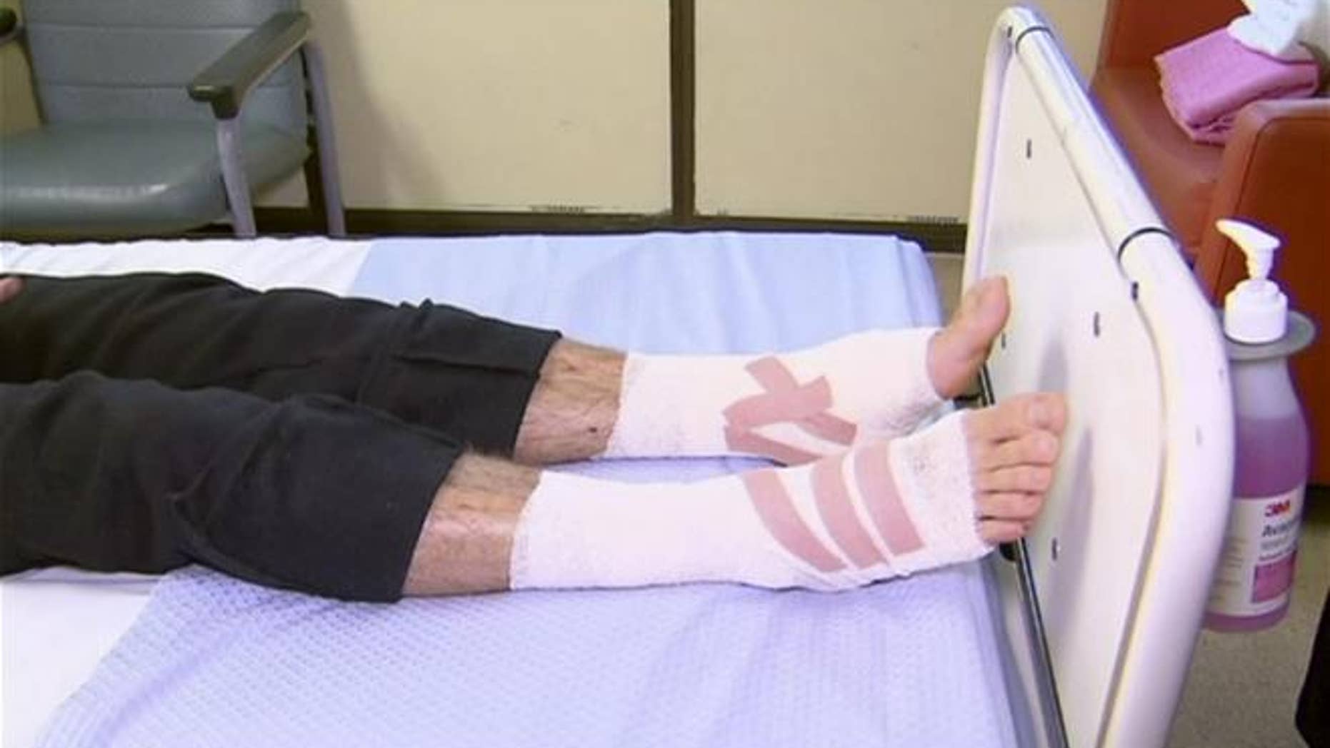 In this image made from video, legs of Sam Kanizay, 16, are seen on a bed of a hospital where he is treated, in Melbourne, Australia.